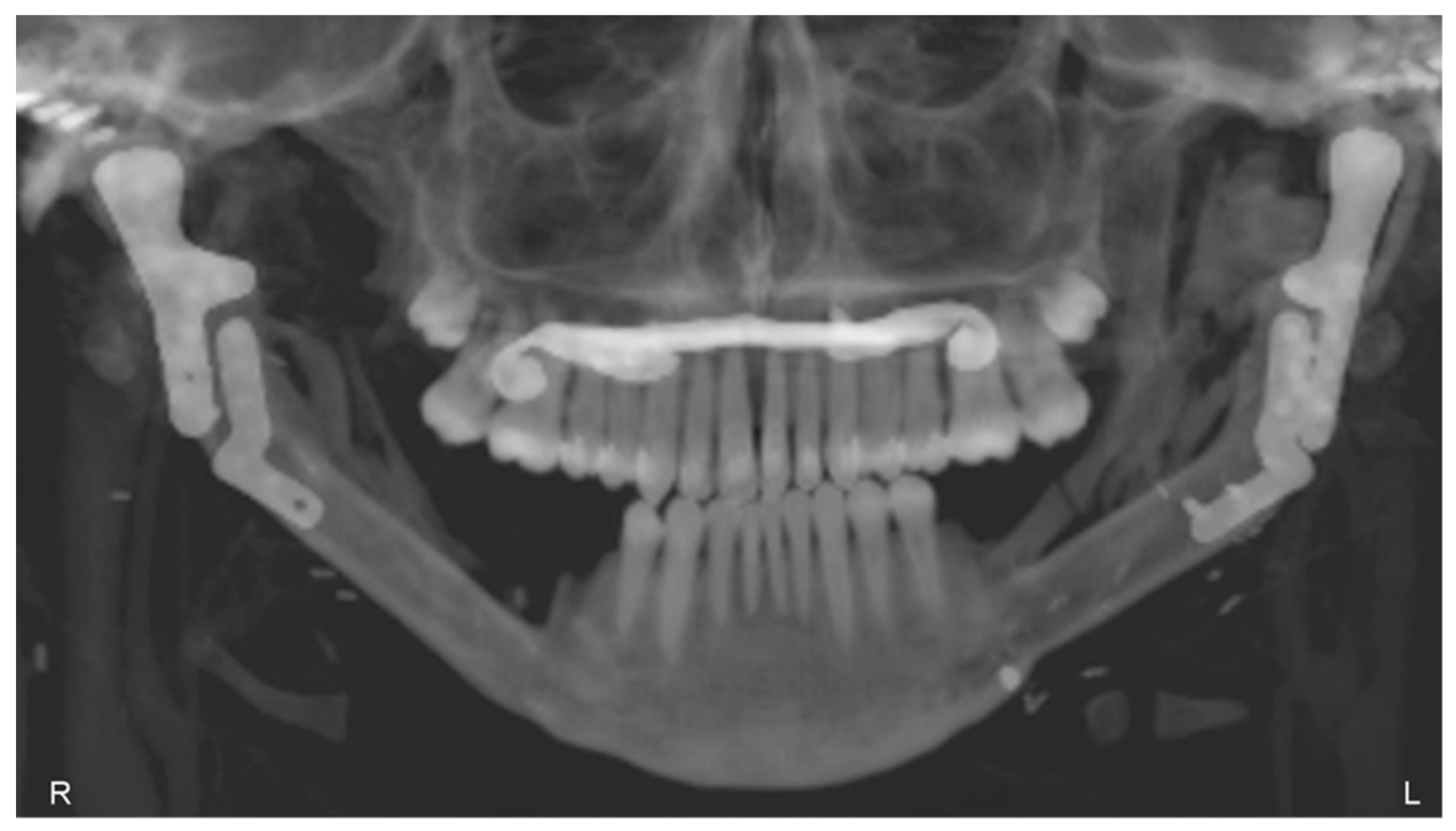 Bioengineering 10 00541 g014 Bioengineering 10 00541 g014