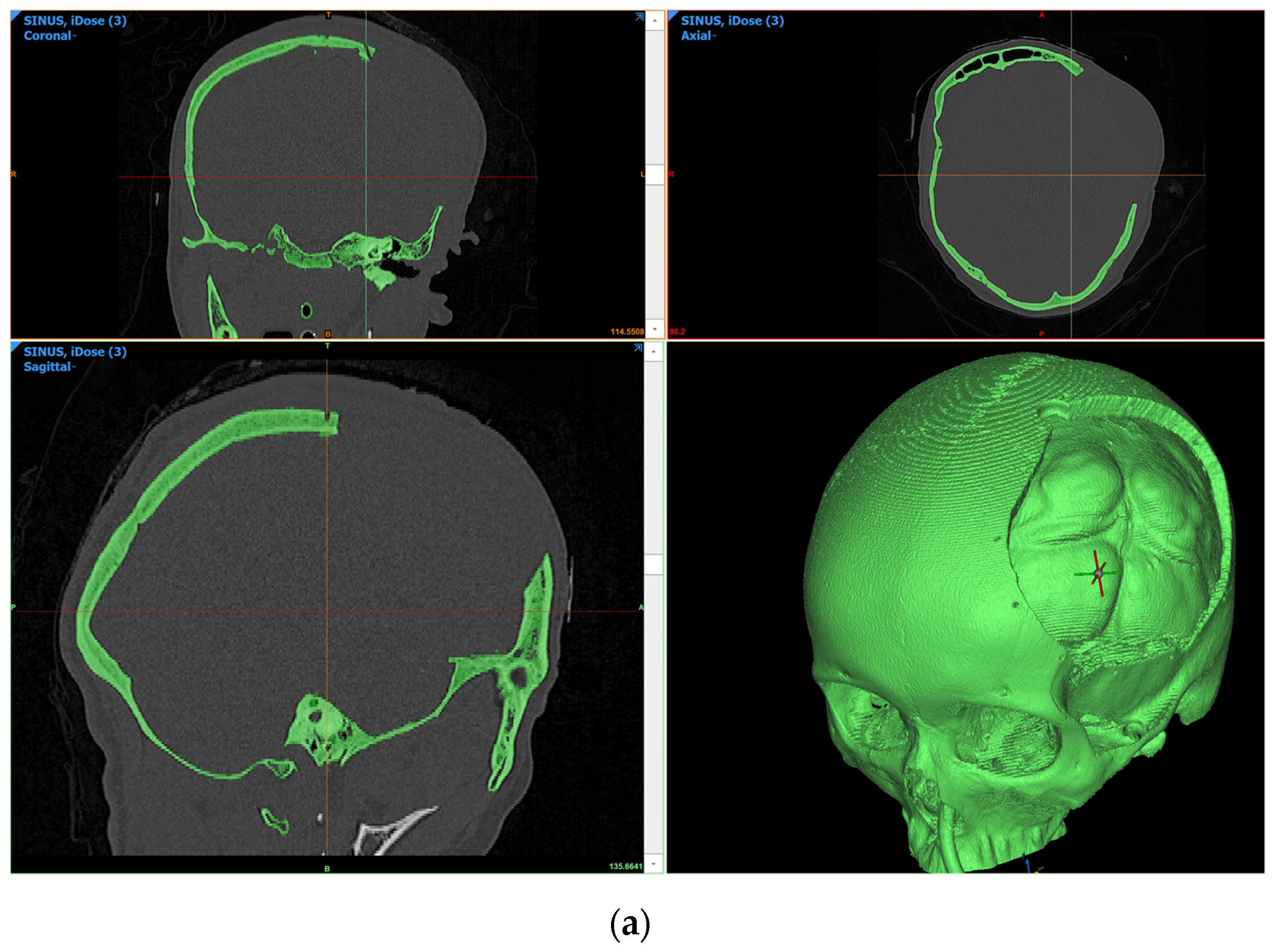 Bioengineering 10 00544 g003a Bioengineering 10 00544 g003a