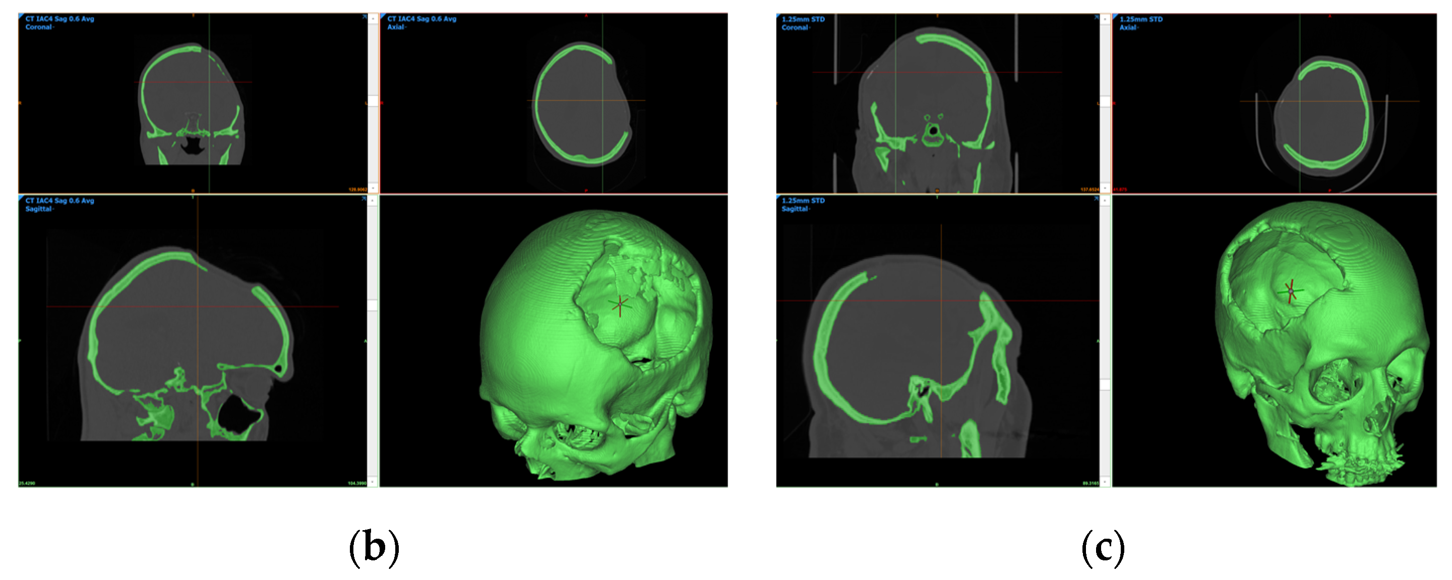 Bioengineering 10 00544 g003b Bioengineering 10 00544 g003b