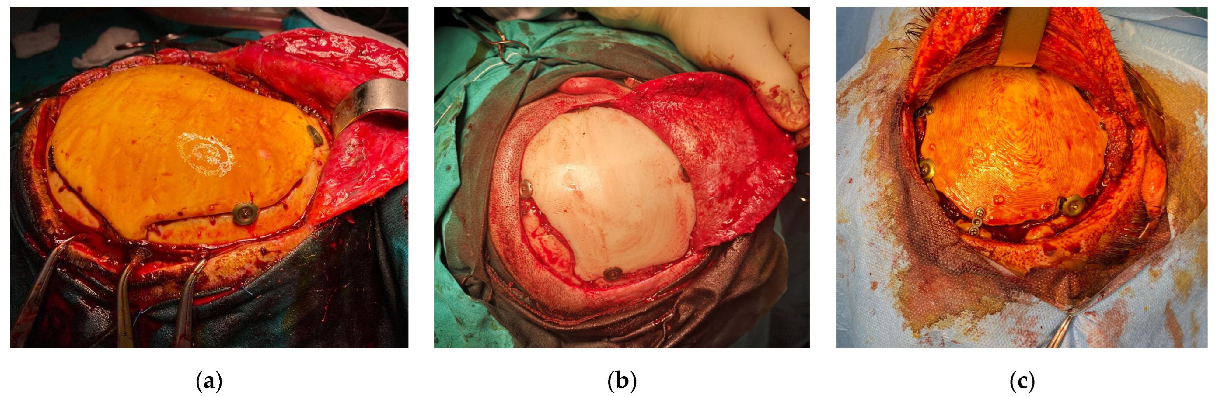 Bioengineering 10 00544 g006 Bioengineering 10 00544 g006
