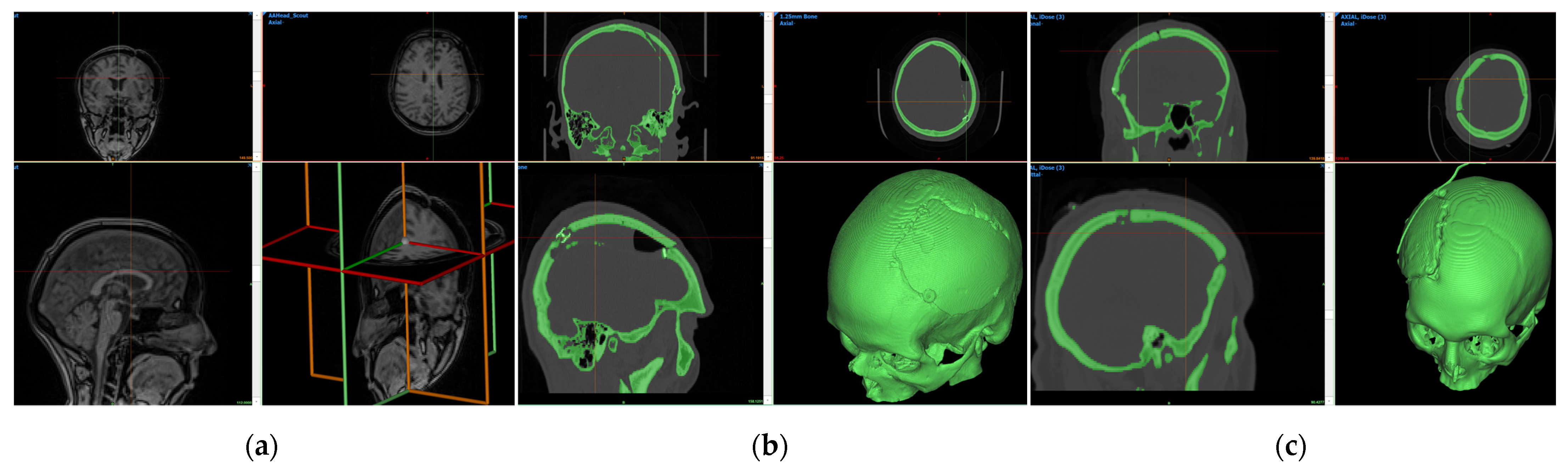 Bioengineering 10 00544 g007 Bioengineering 10 00544 g007