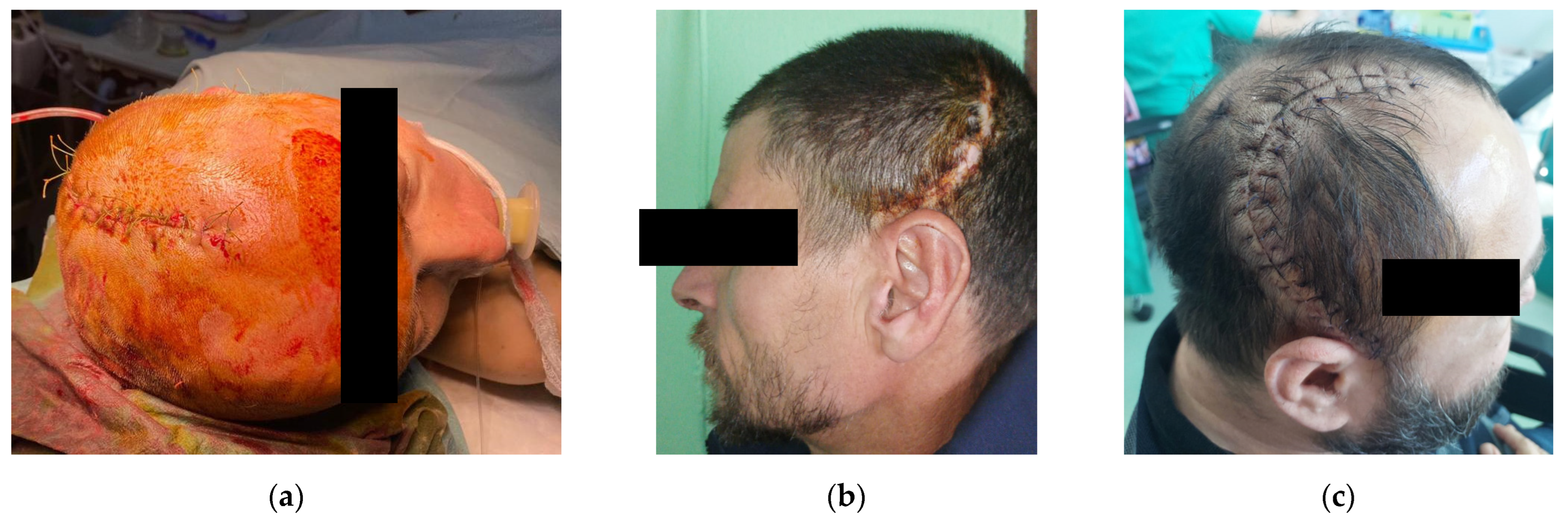 Bioengineering 10 00544 g008 Bioengineering 10 00544 g008
