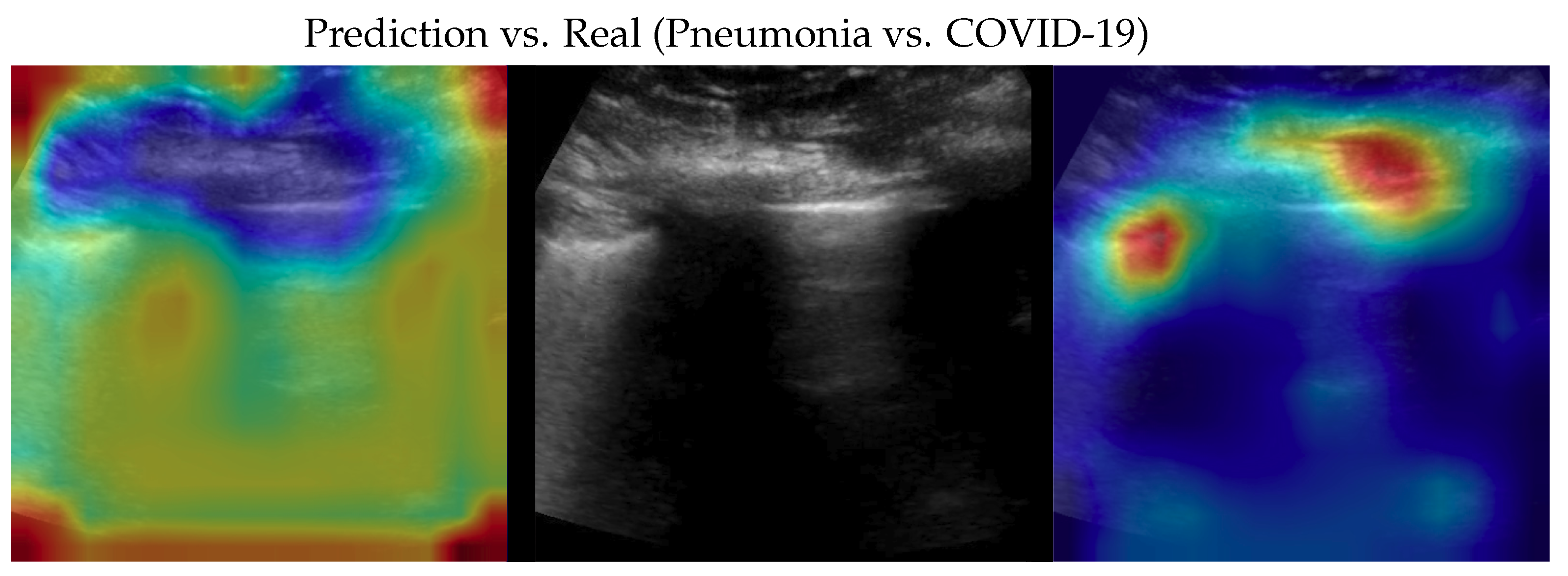 Bioengineering 10 00555 g005