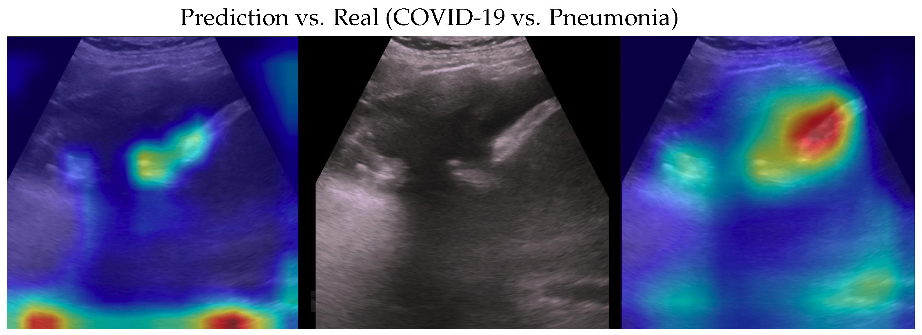 Bioengineering 10 00555 g007