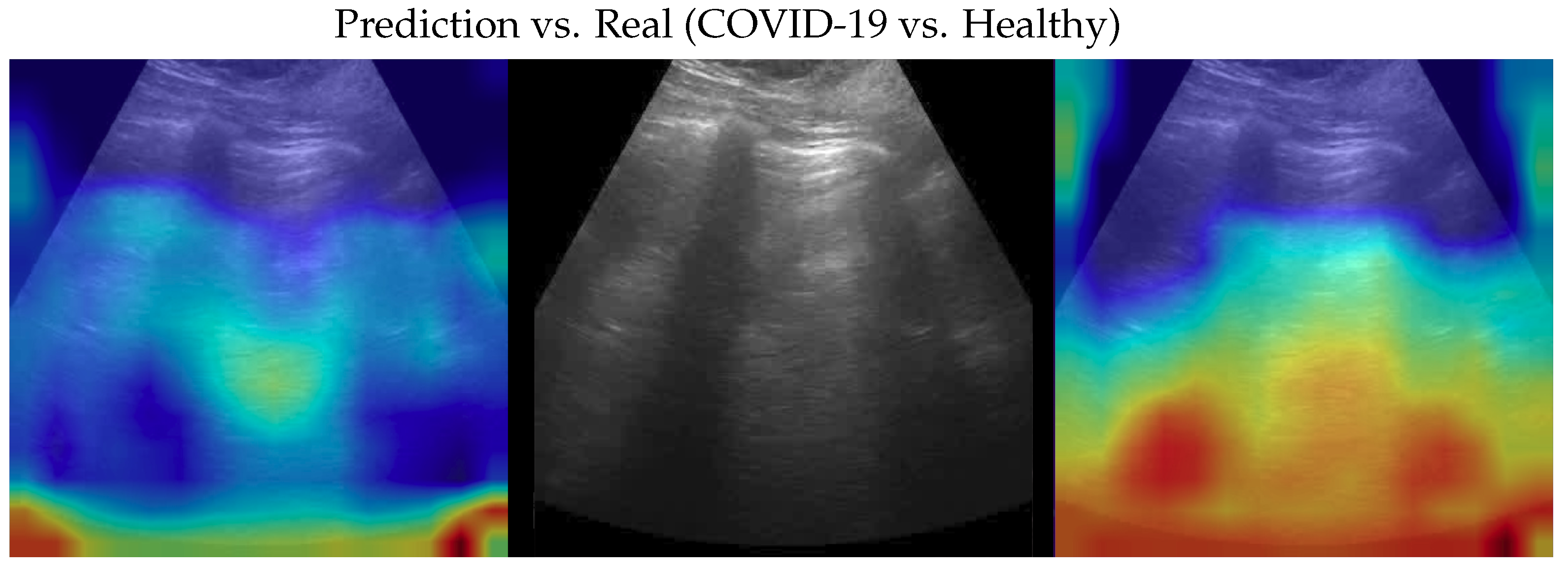 Bioengineering 10 00555 g008