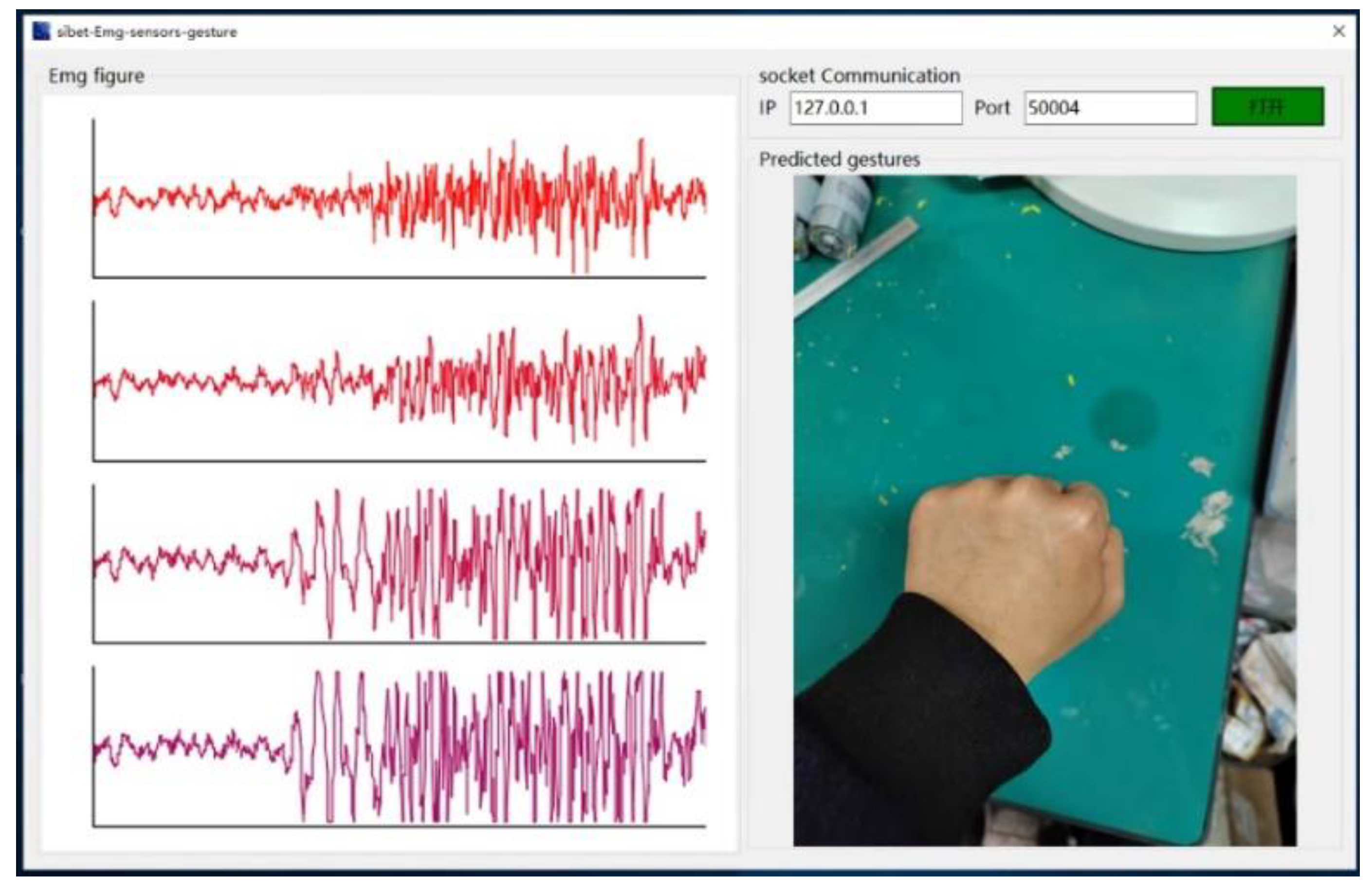 Bioengineering 10 00557 g016