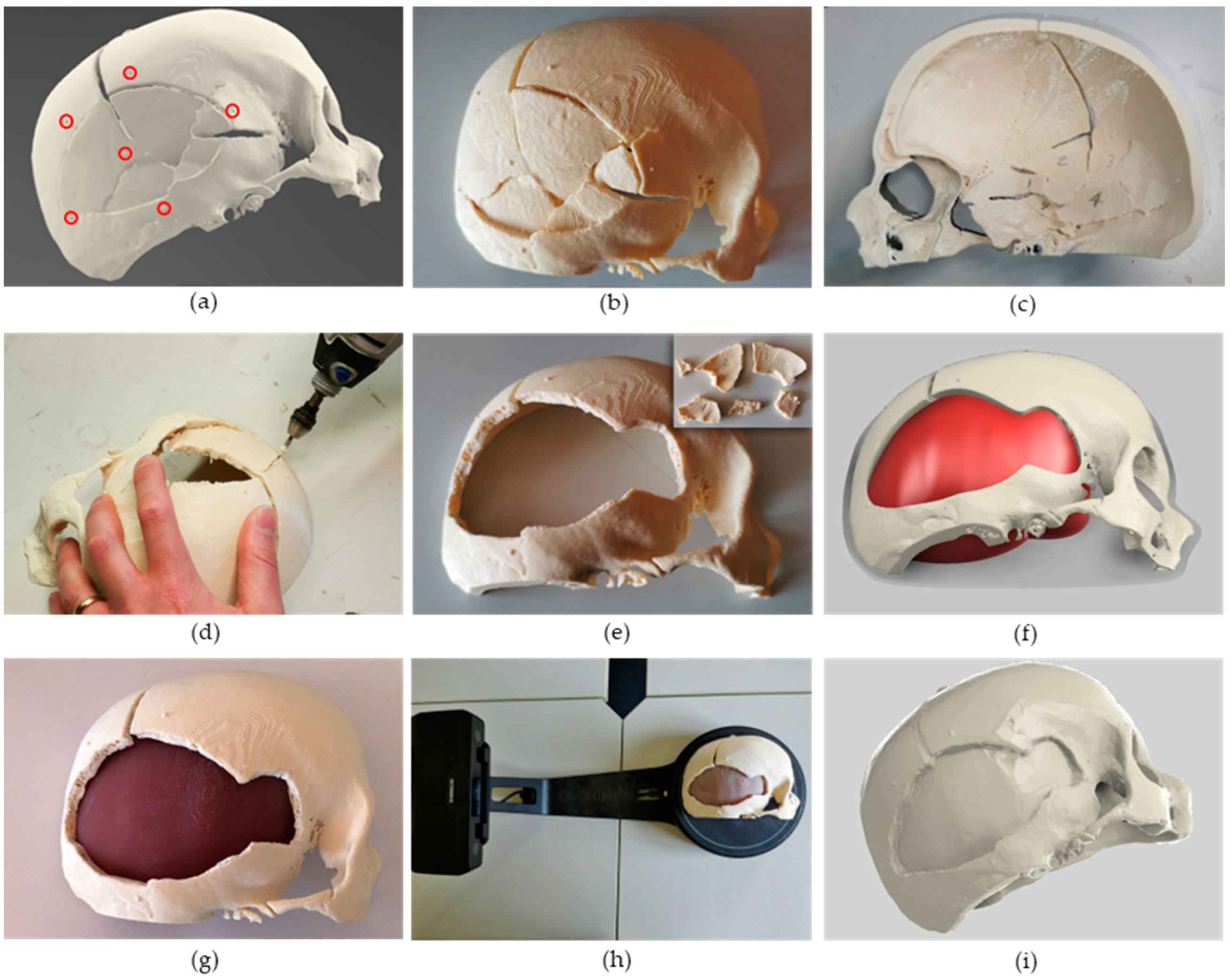 Bioengineering 10 00560 g003 Bioengineering 10 00560 g003