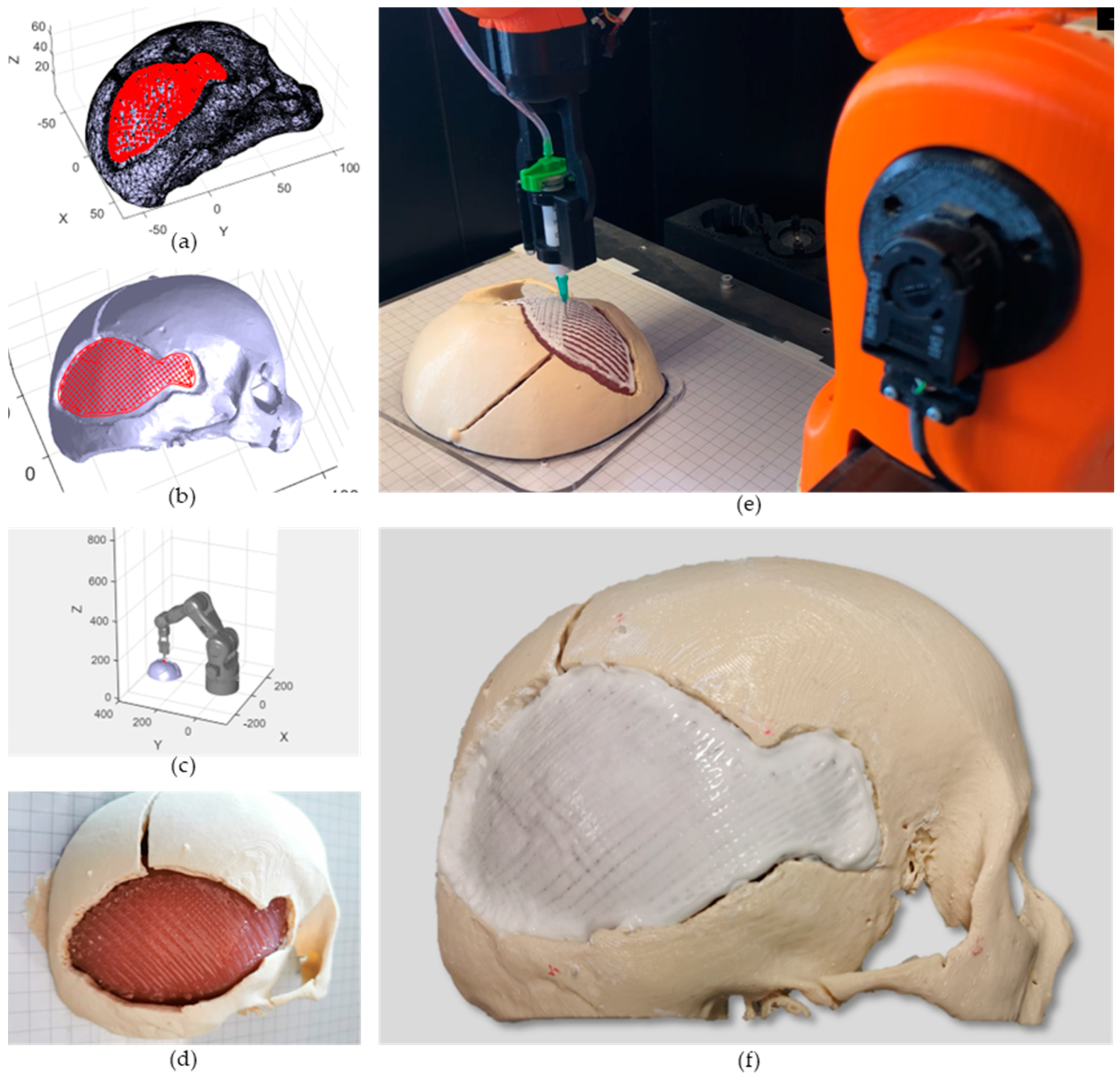 Bioengineering 10 00560 g005 Bioengineering 10 00560 g005