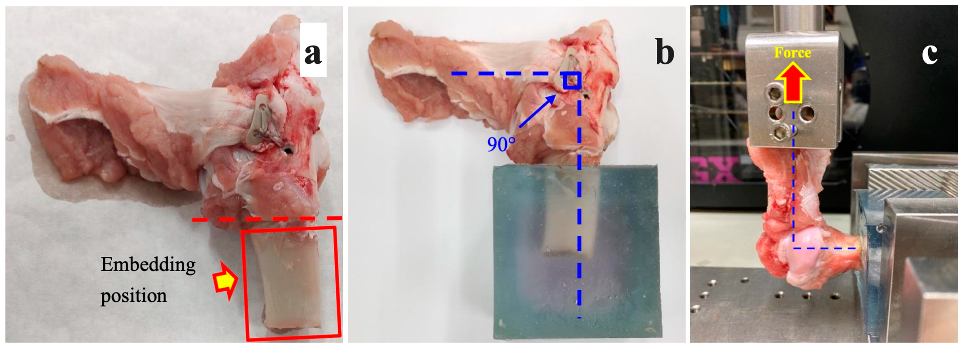 Bioengineering 10 00565 g003
