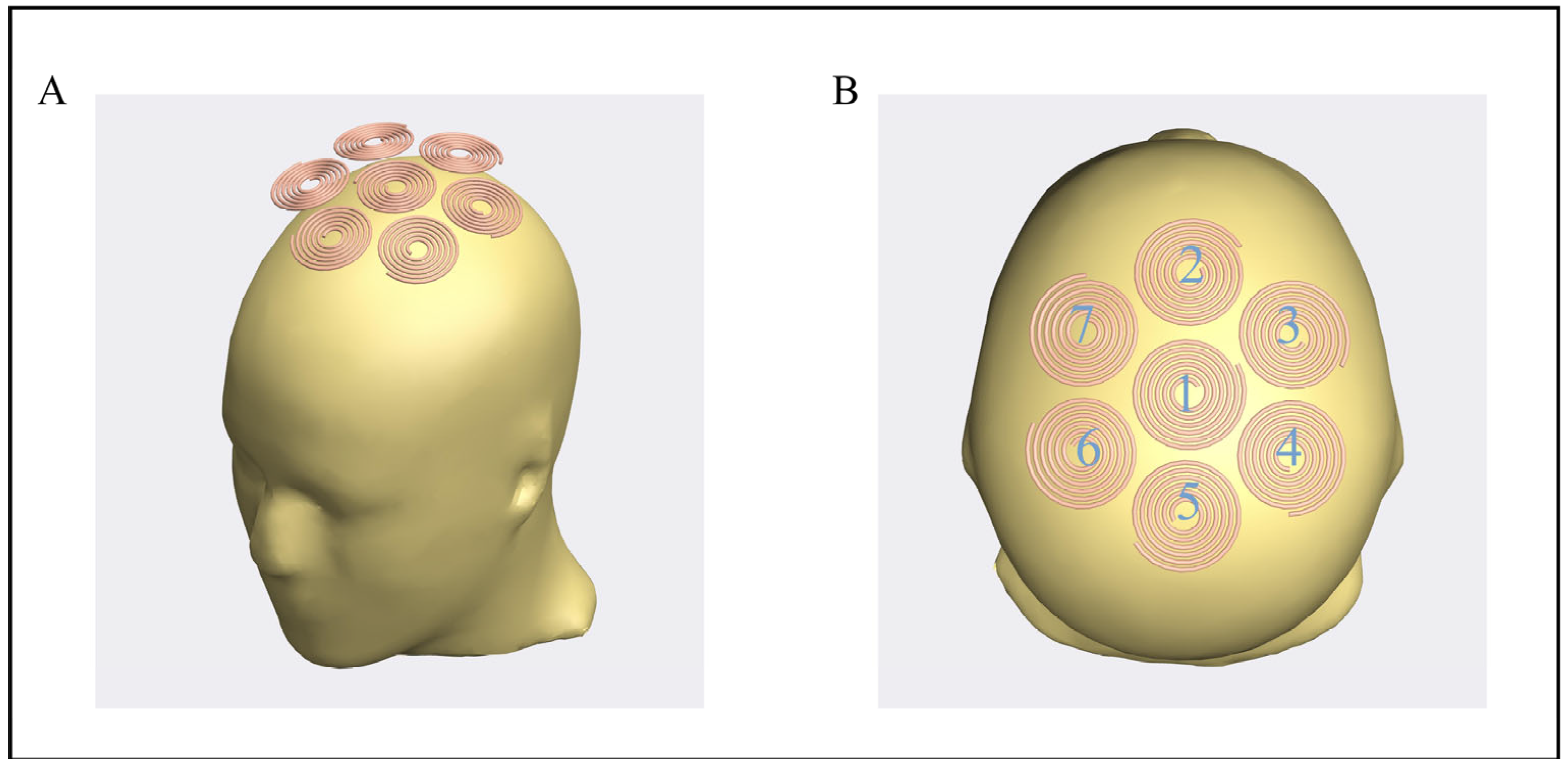 Bioengineering Free FullText Optimal Design of Array Coils for