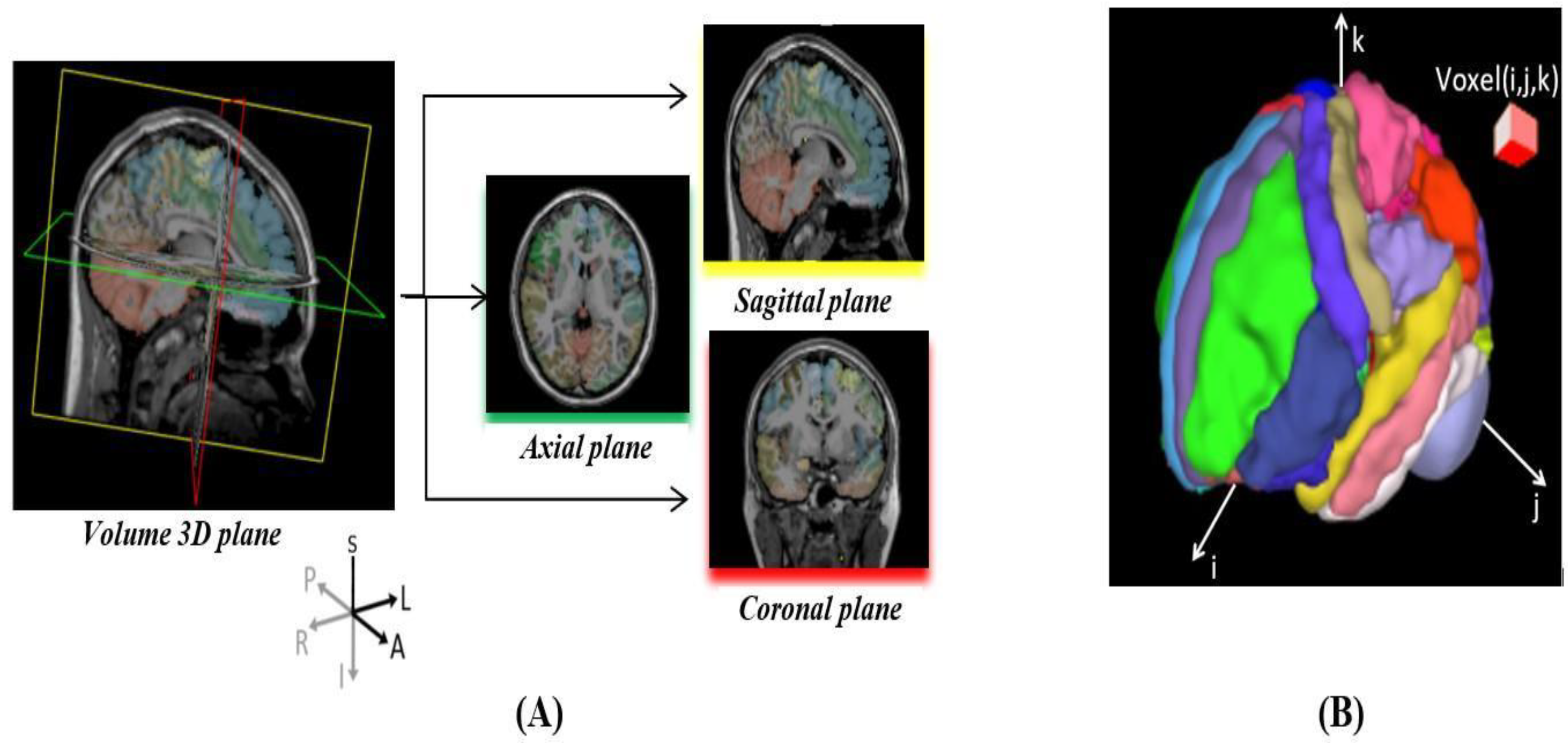 Brain tumor segmentation based on deep learning and an attention mechanism  using MRI multi-modalities brain images