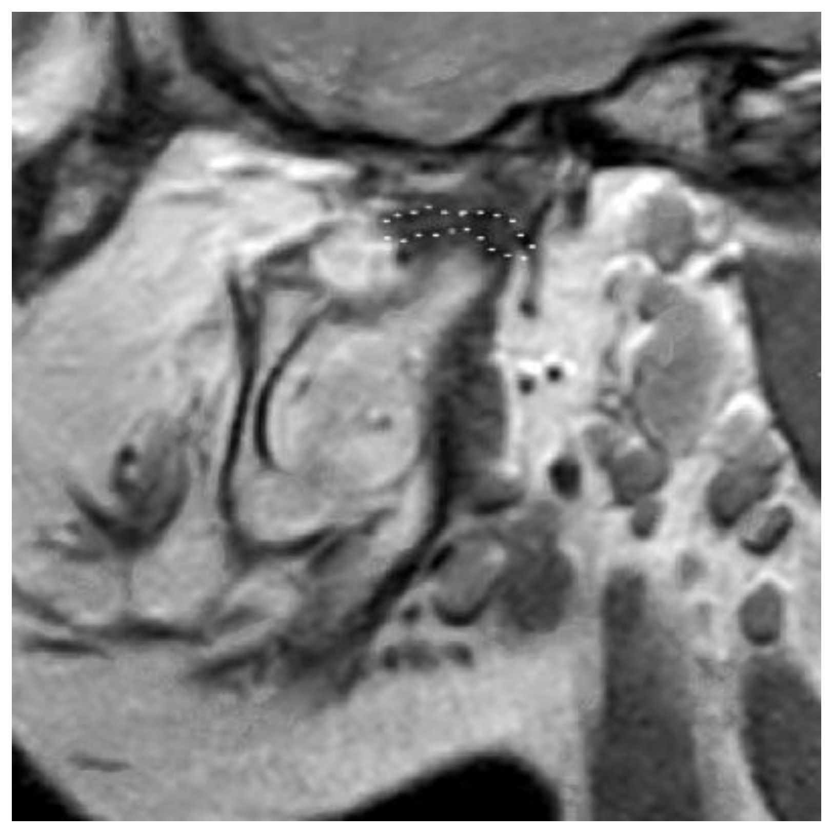 Bioengineering 10 00595 g003