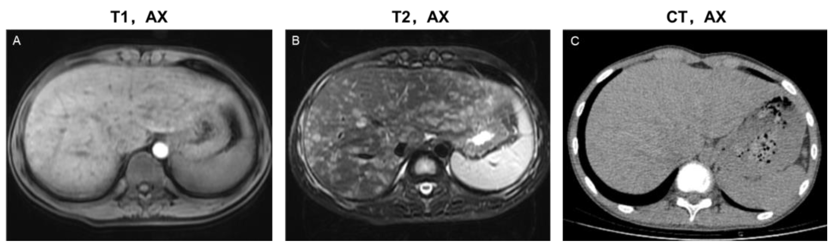 Bioengineering 10 00598 g003 Bioengineering 10 00598 g003