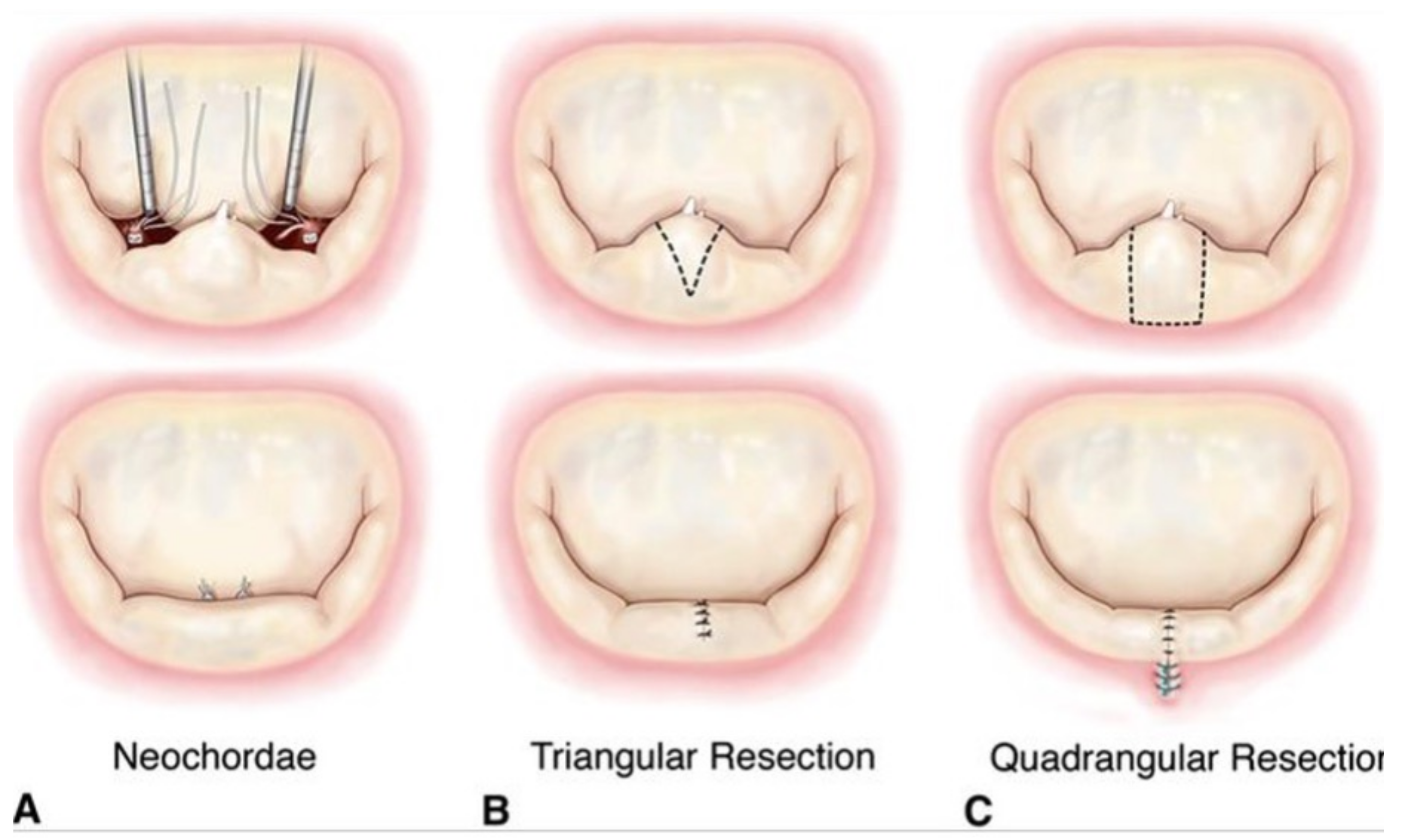Bioengineering 10 00601 g014