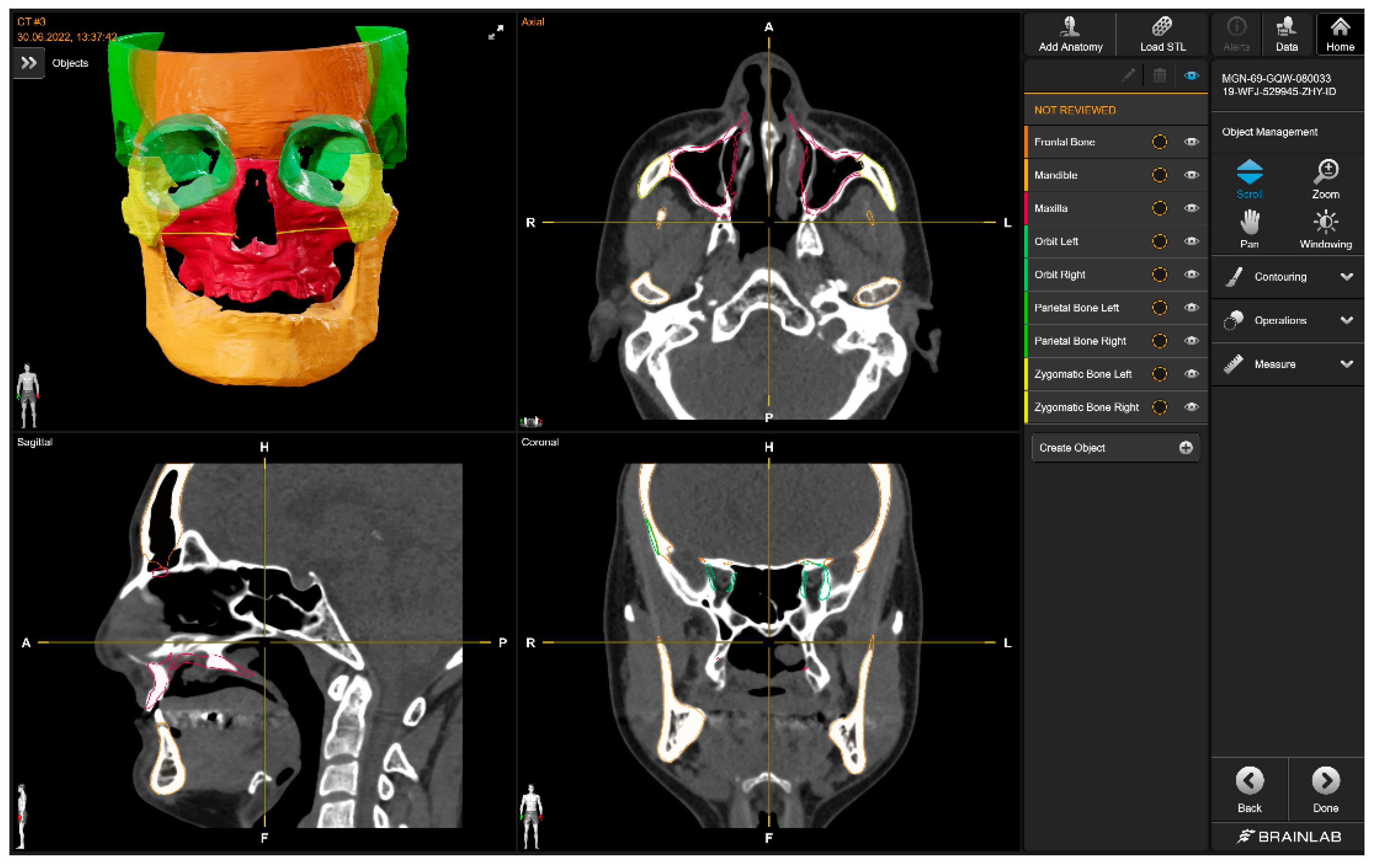 Bioengineering 10 00604 g007