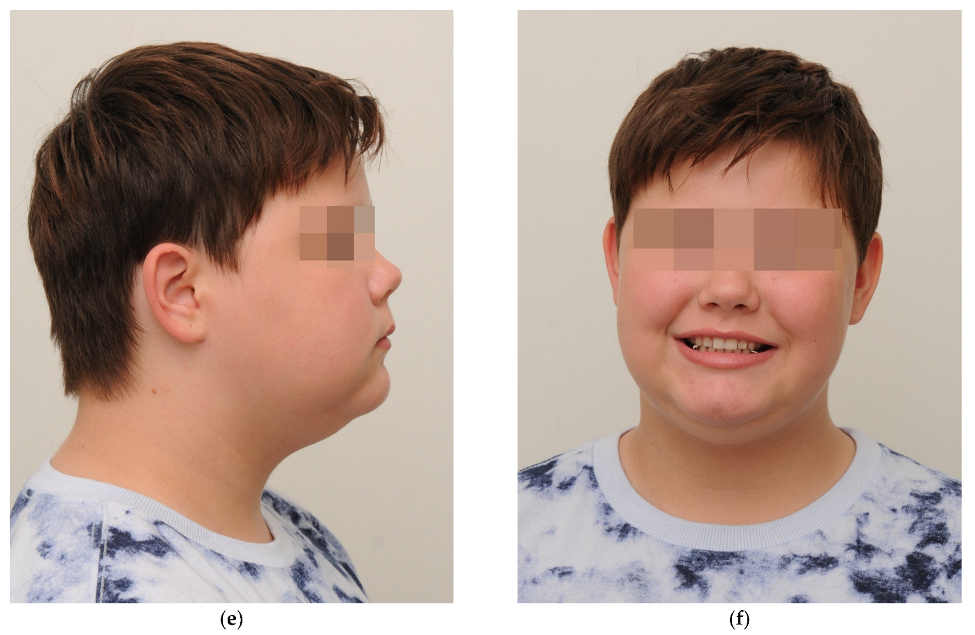 Bioengineering 10 00616 g003b