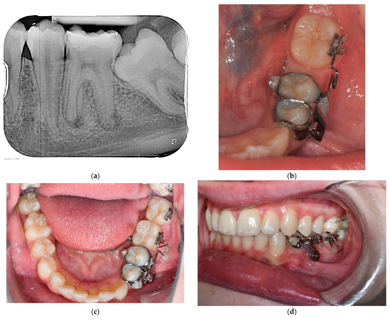 Bioengineering 10 00616 g005a