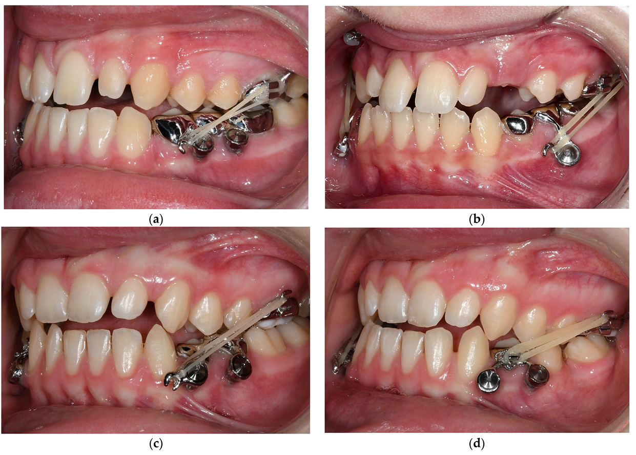 Bioengineering 10 00616 g006