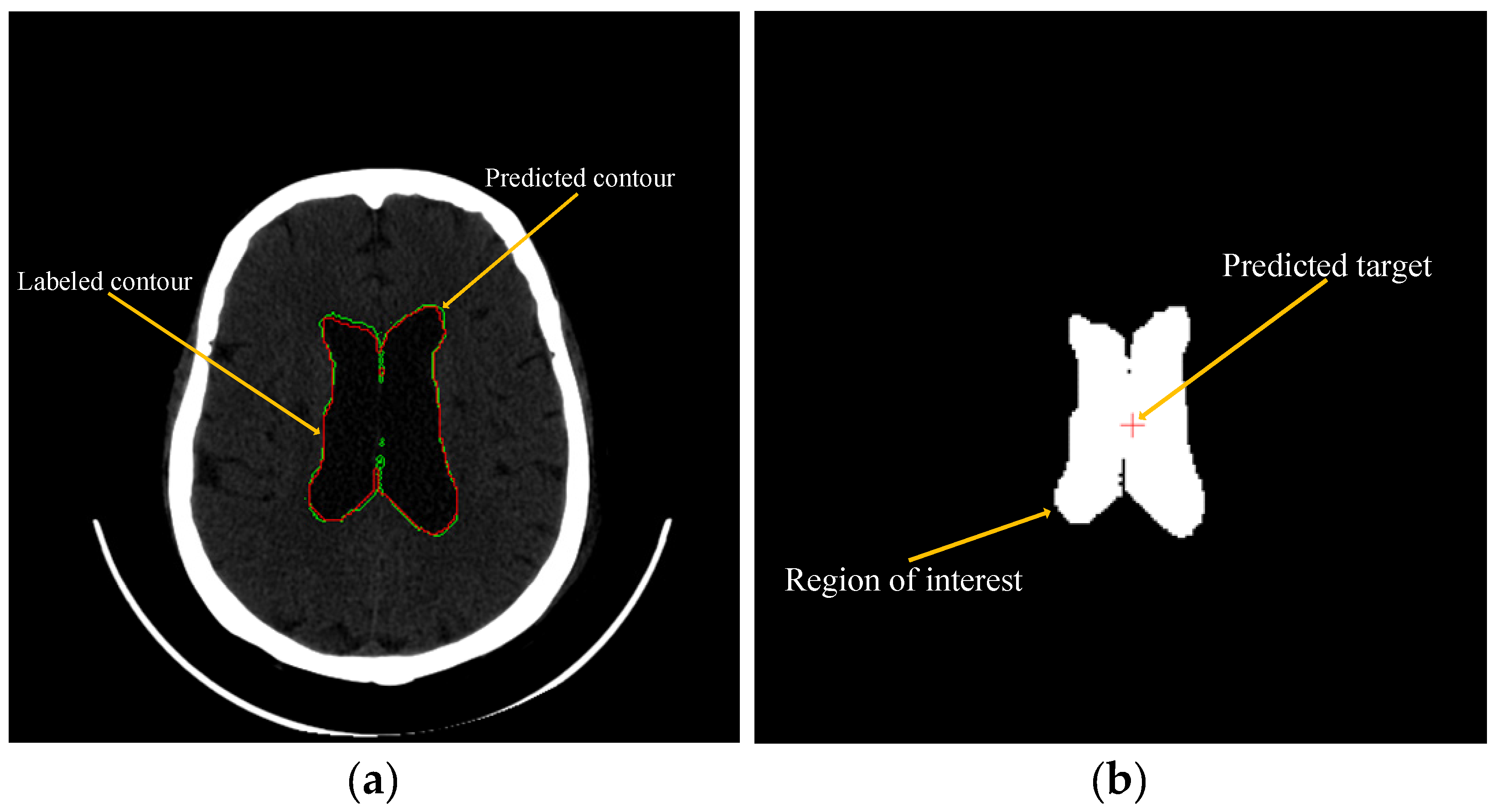 Bioengineering 10 00617 g004