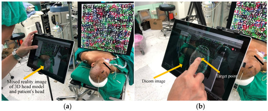 Augmented Reality Surgical Navigation System Integrated with Deep Learning