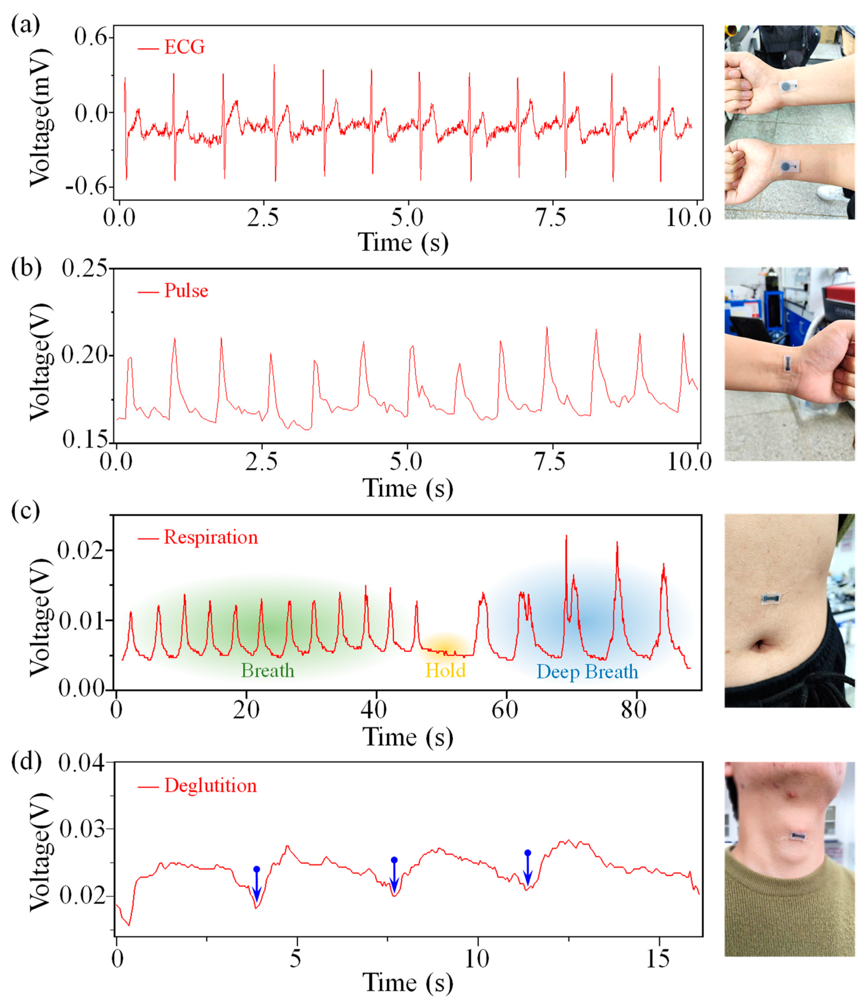 Bioengineering 10 00620 g003 Bioengineering 10 00620 g003