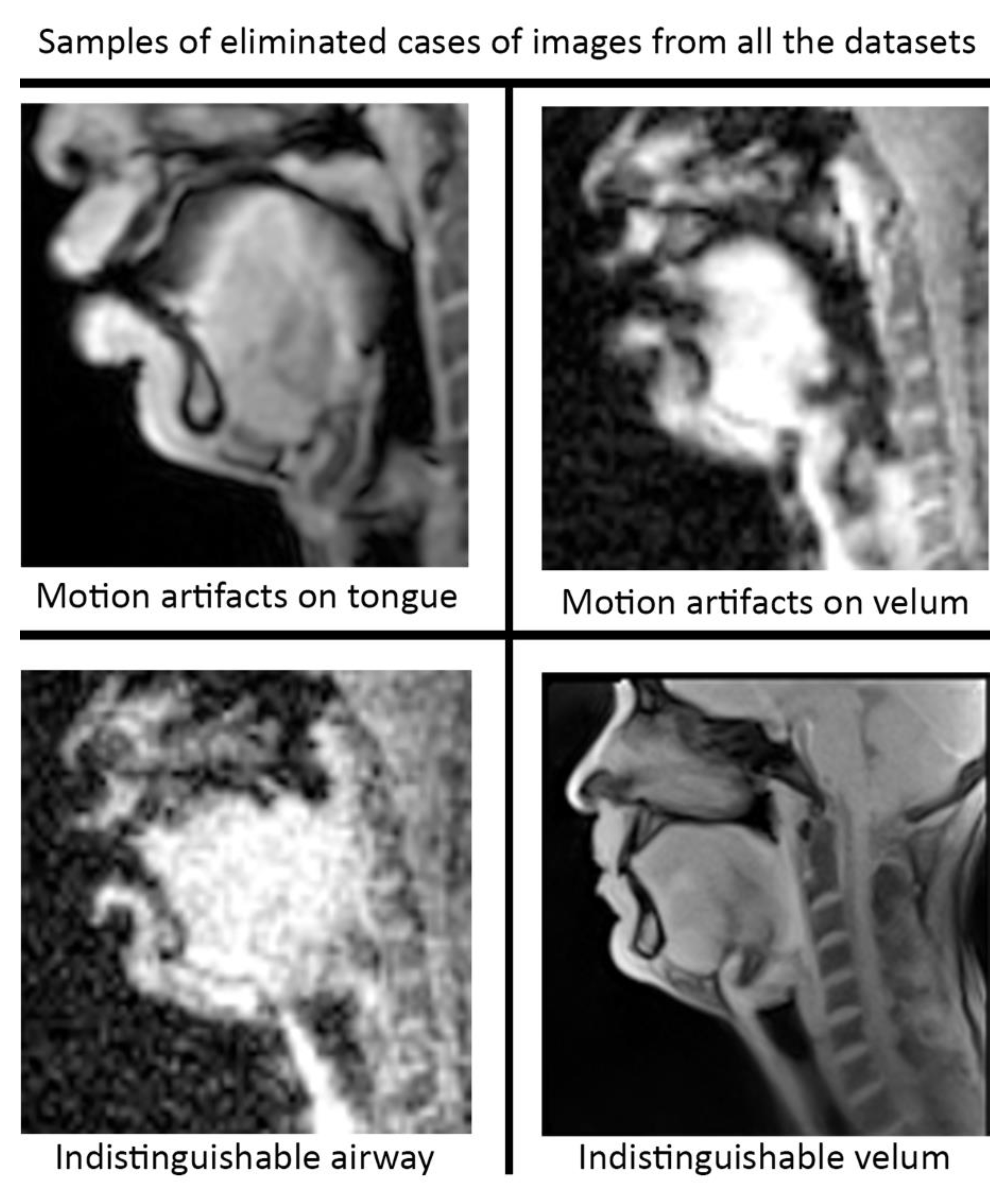 Bioengineering 10 00623 g004