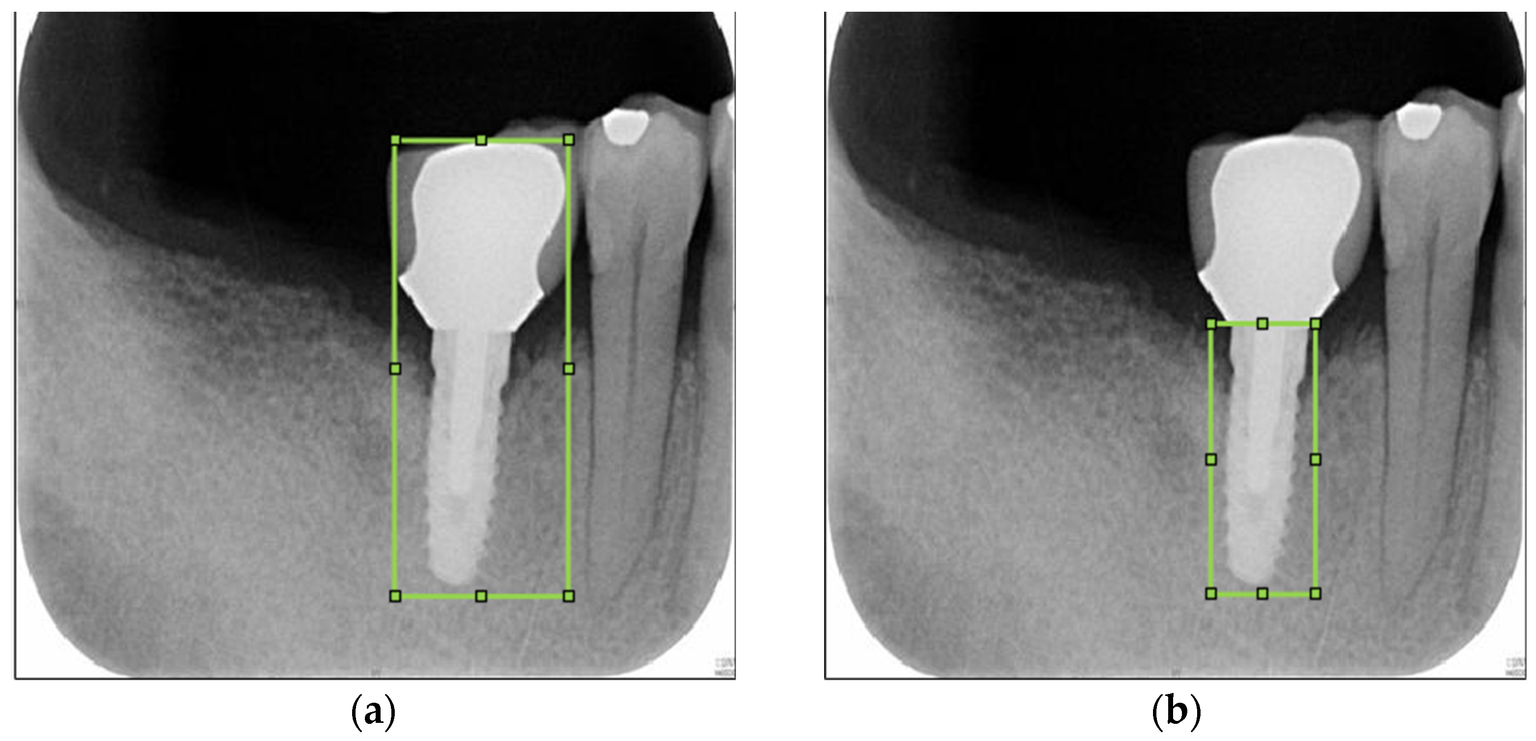 Bioengineering 10 00640 g002
