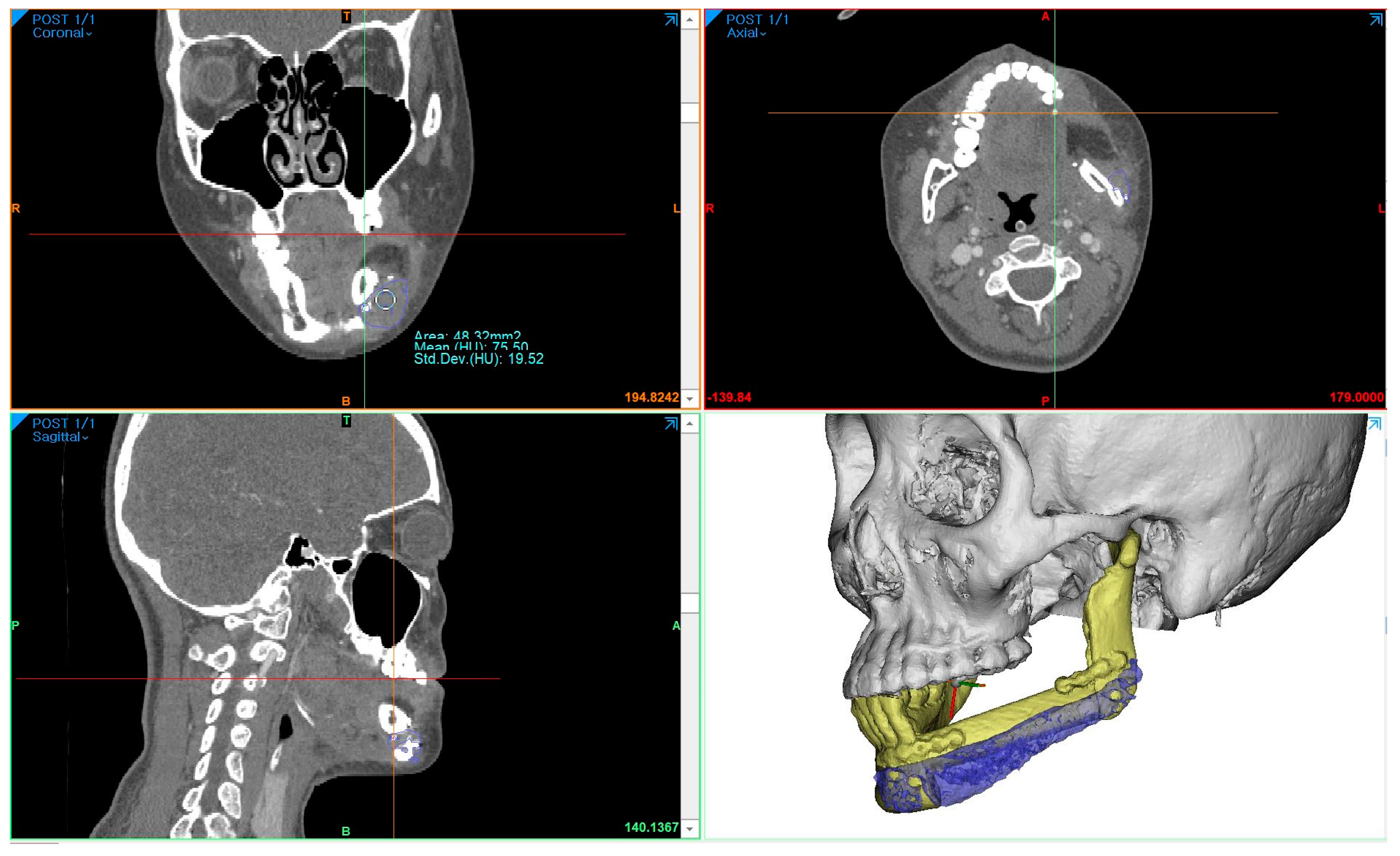 Bioengineering 10 00684 g005