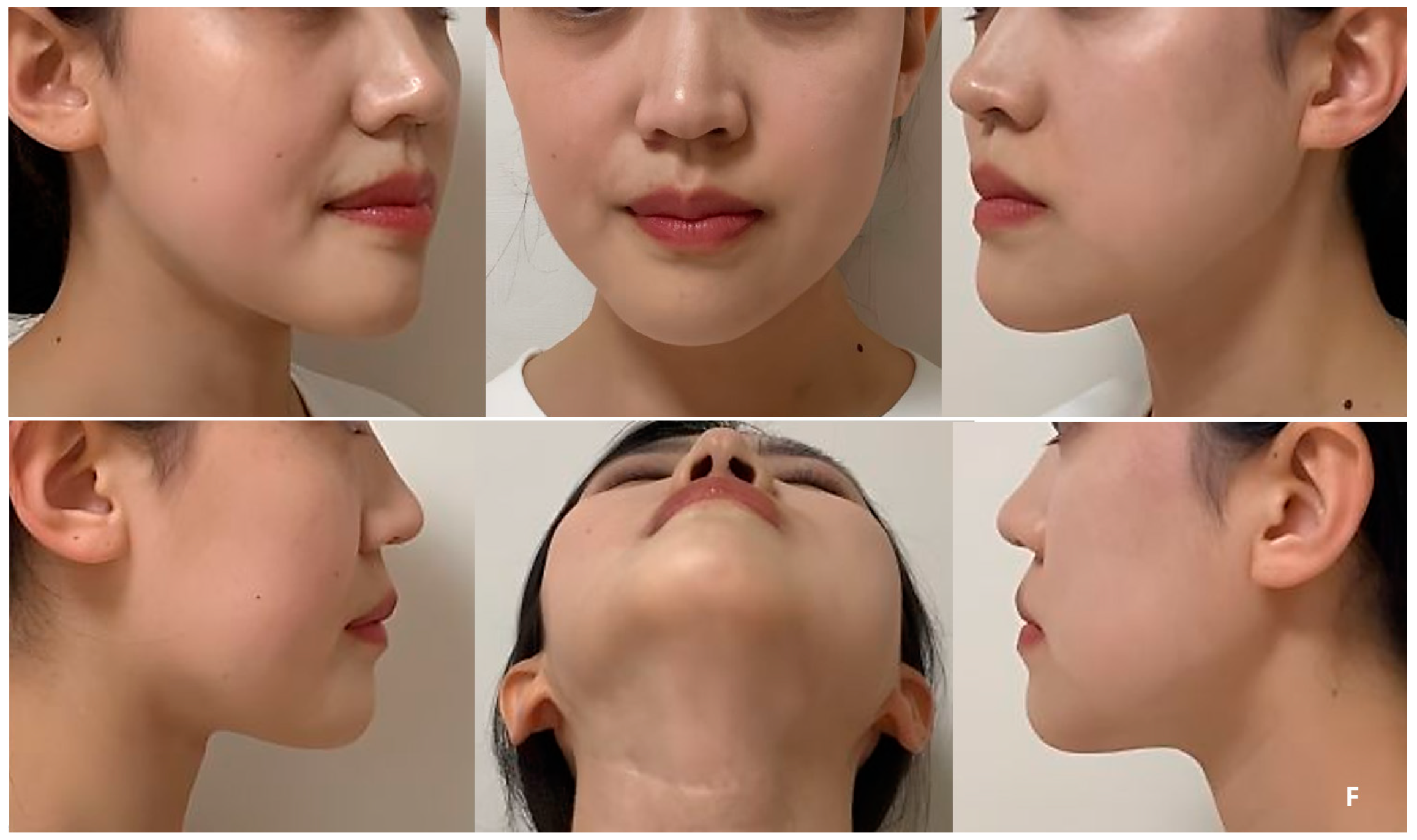 Bioengineering 10 00684 g007b