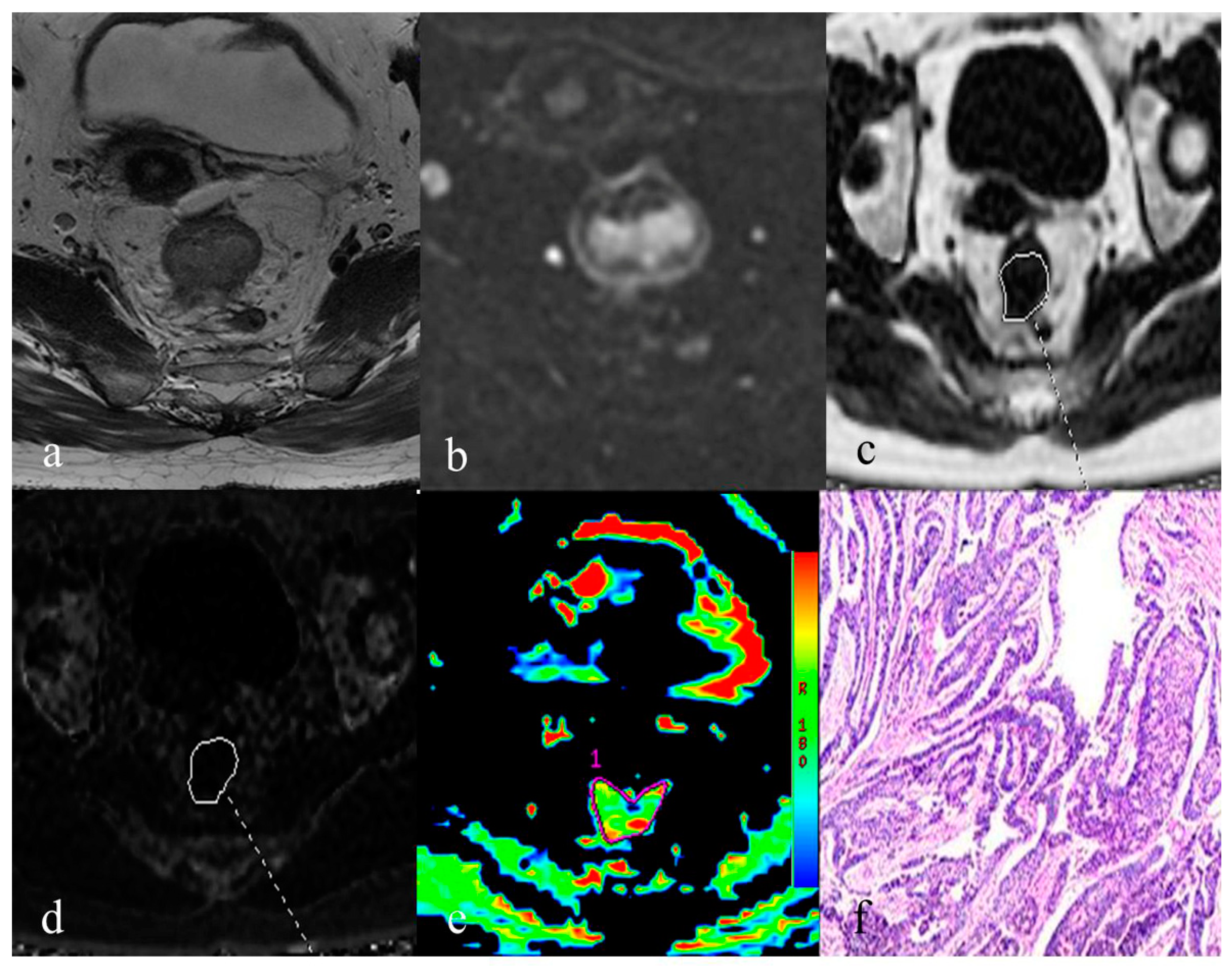 Bioengineering 10 00720 g004
