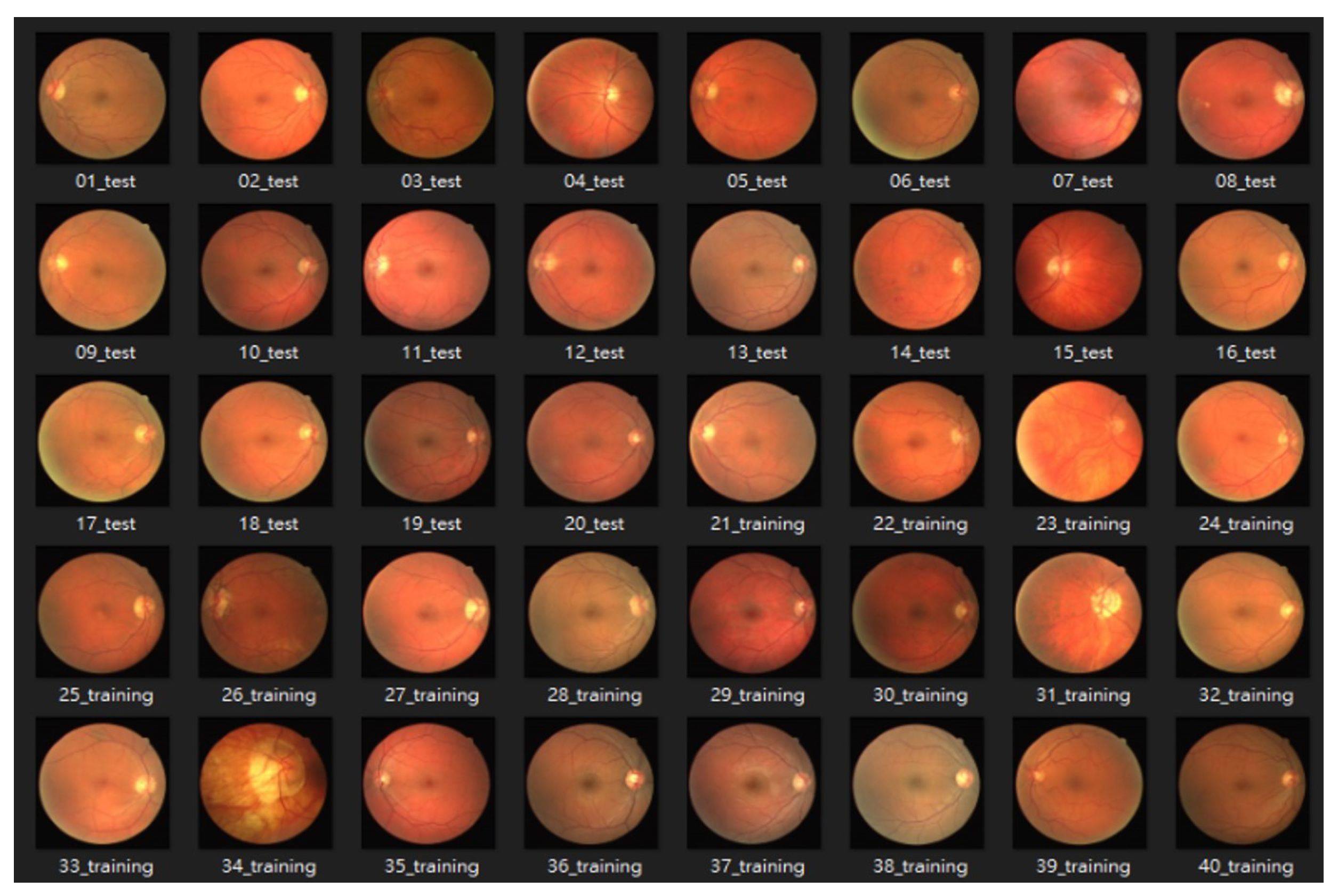 Bioengineering 10 00722 g008