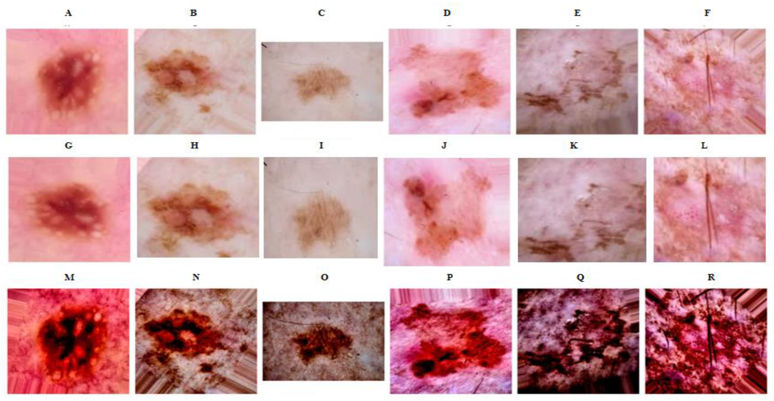 Bioengineering 10 00732 g004