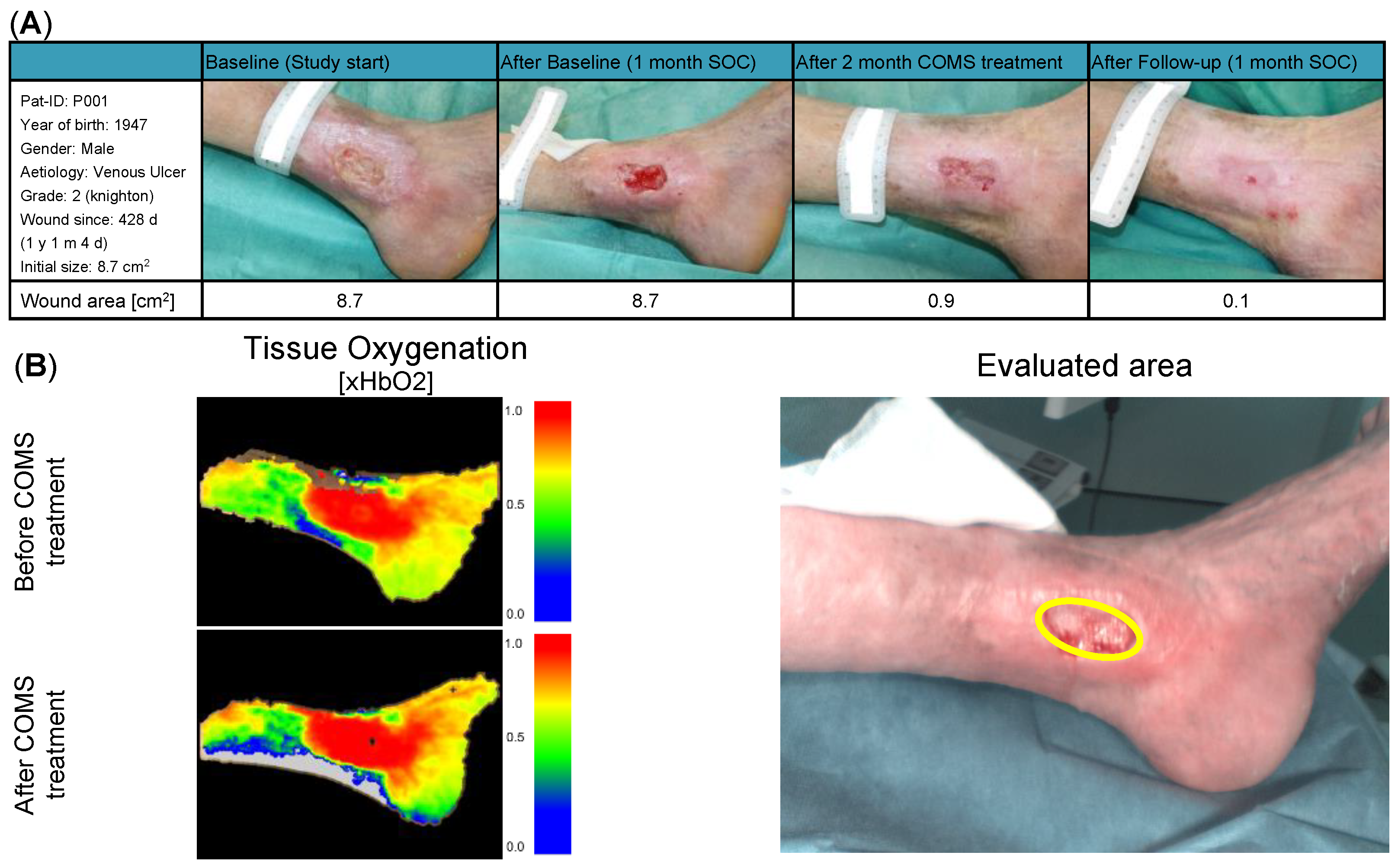 Bioengineering 10 00750 g004 Bioengineering 10 00750 g004