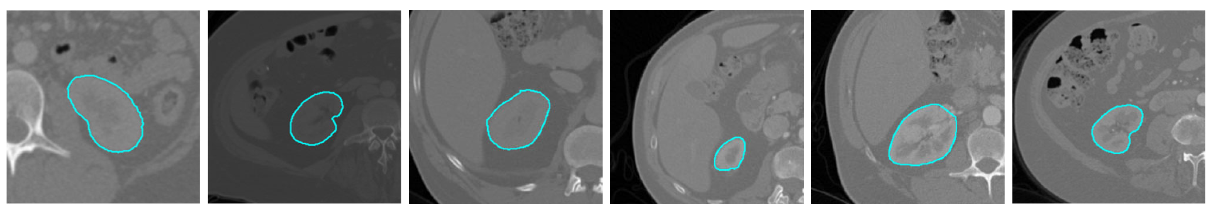 Bioengineering 10 00755 g004 Bioengineering 10 00755 g004