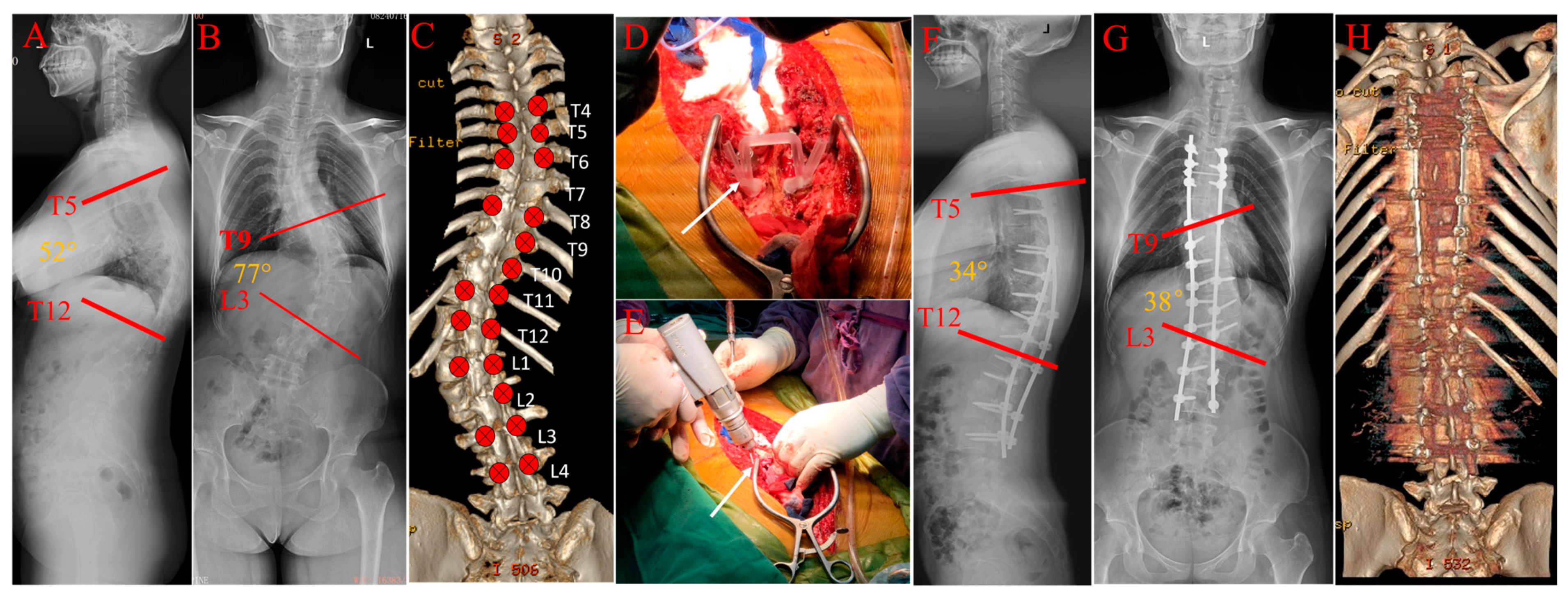 Bioengineering 10 00756 g004