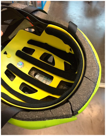 bike helmets tbi ATB-2T Ascent Matte Black / X-Large / XX-Large Directional Suspension technology. Injury lawyers, Brain Injury Association