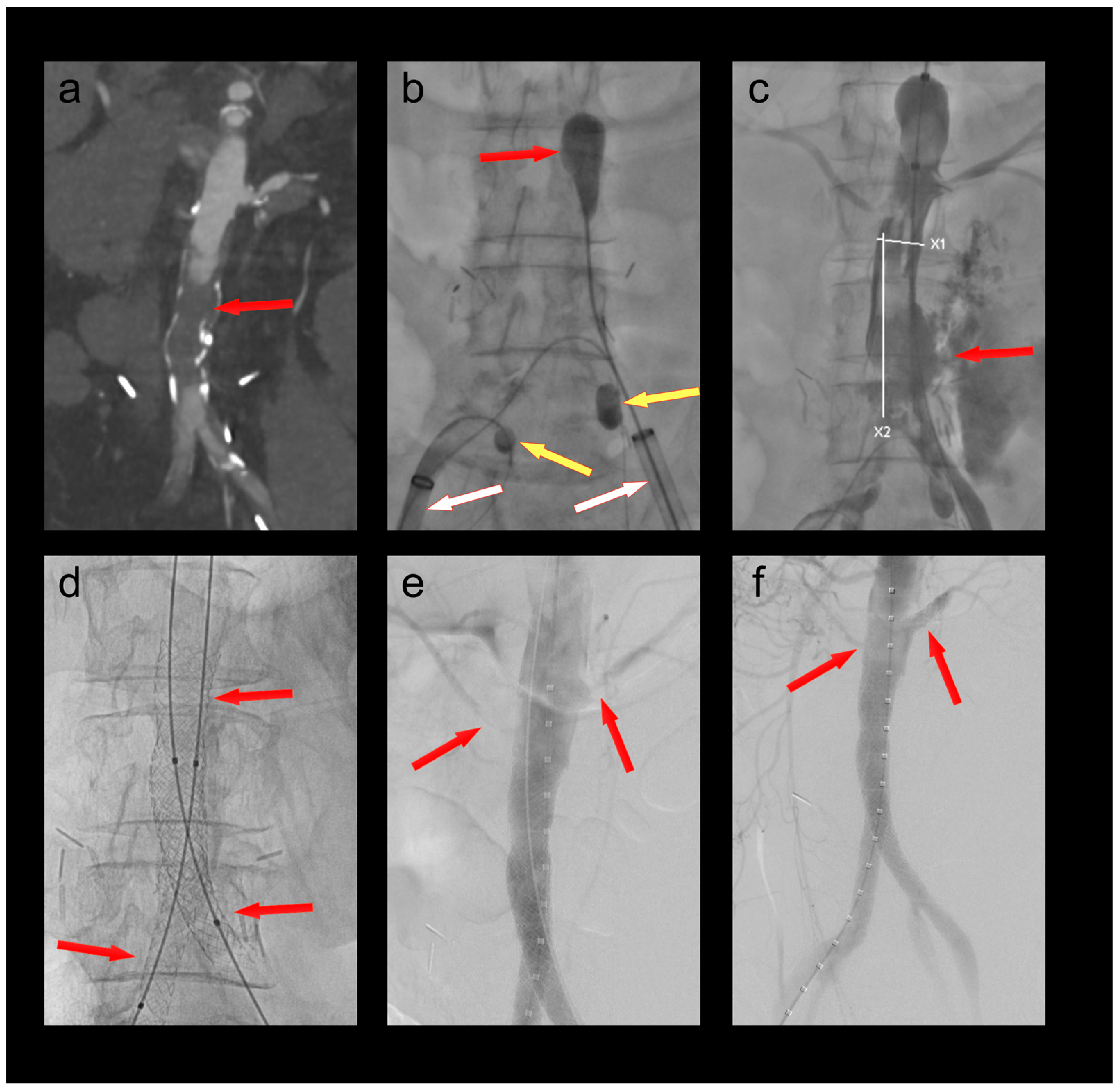 Bioengineering 10 00778 g003