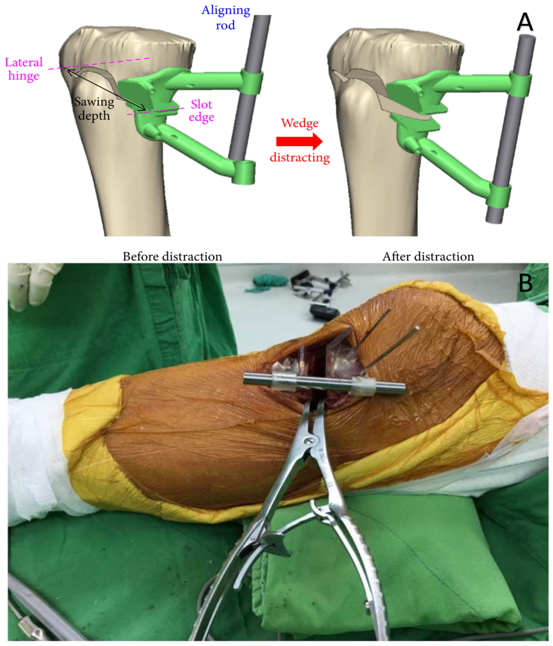 Bioengineering 10 00782 g013