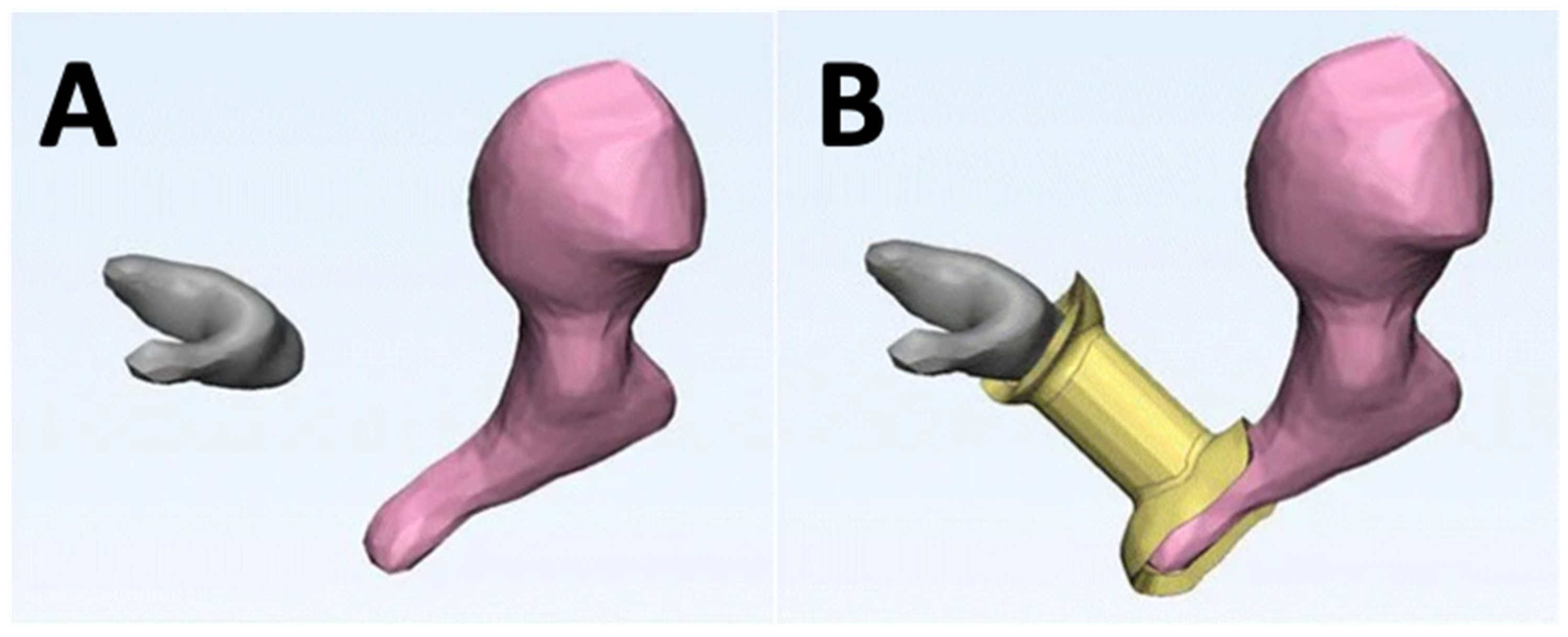Bioengineering 10 00782 g014