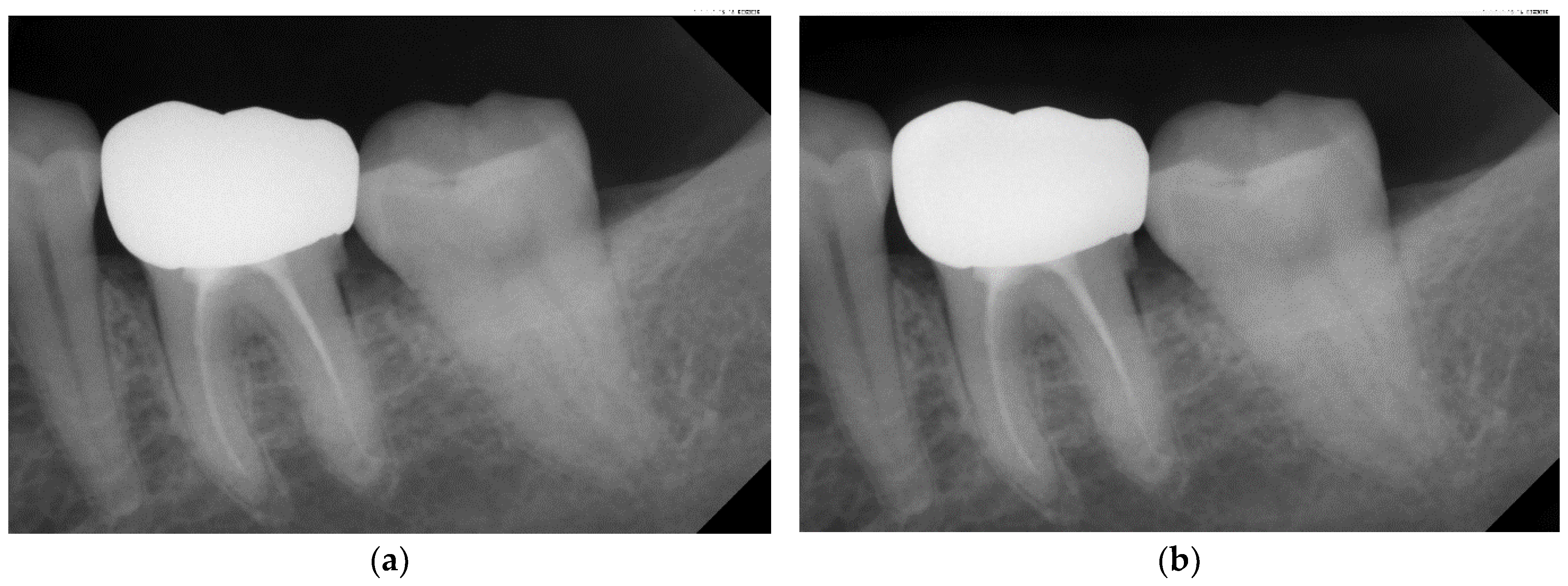 Bioengineering 10 00802 g003