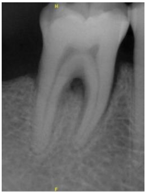 Bioengineering 10 00802 i001