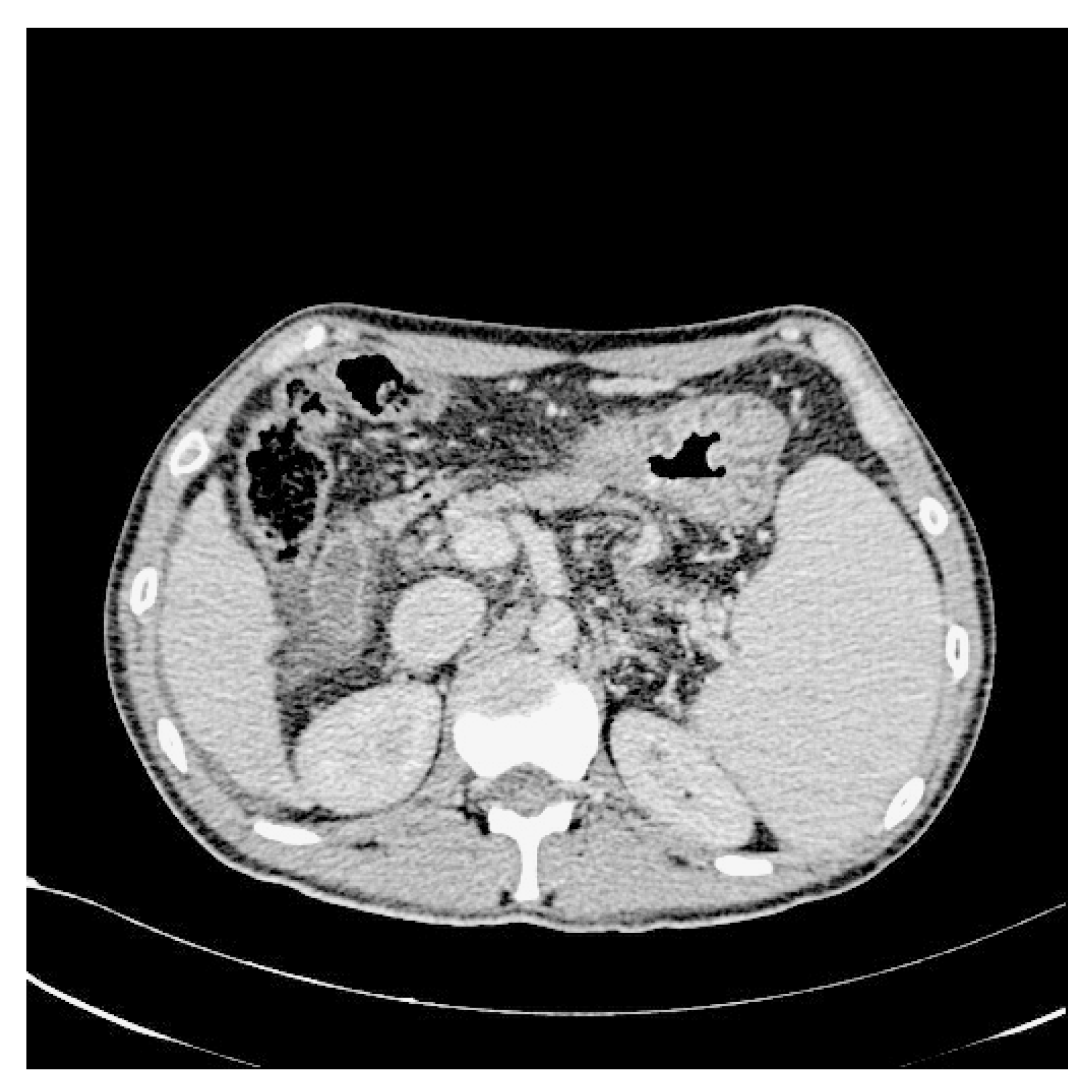 Bioengineering 10 00828 g004 Bioengineering 10 00828 g004