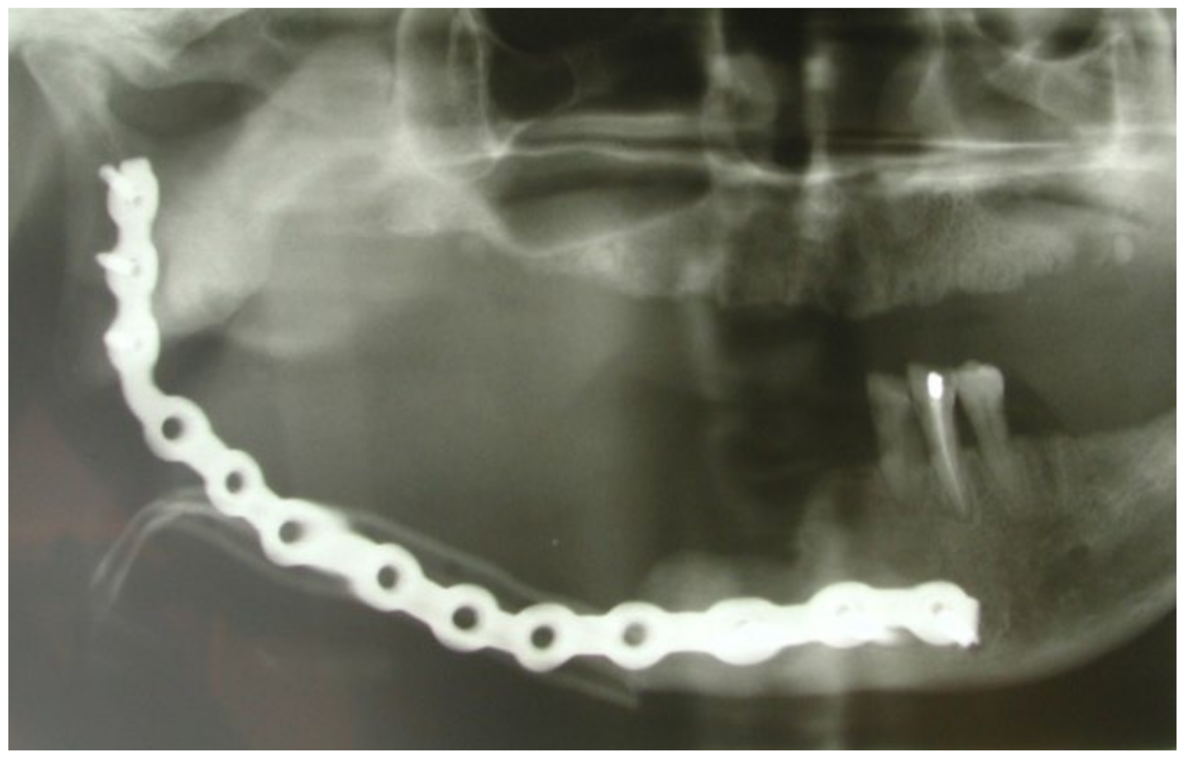 Bioengineering 10 00863 g005