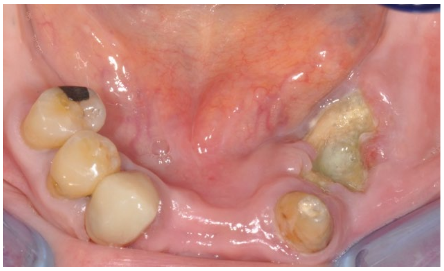 Bioengineering 10 00863 g007
