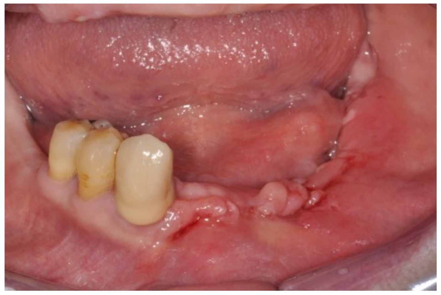 Bioengineering 10 00863 g009
