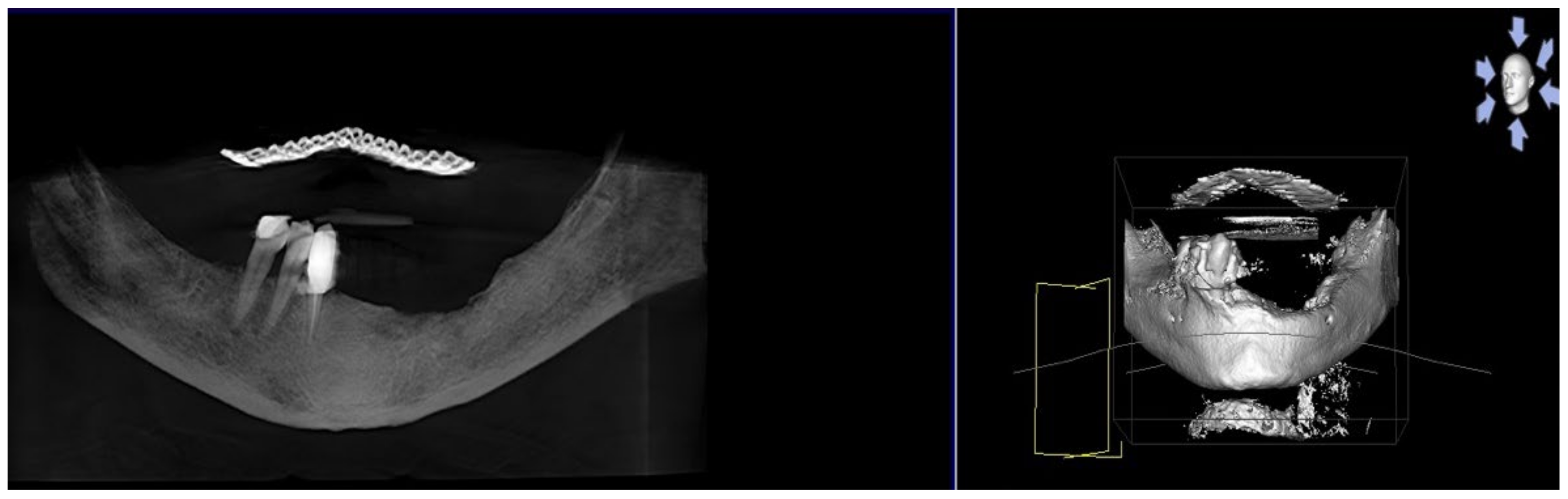 Bioengineering 10 00863 g010