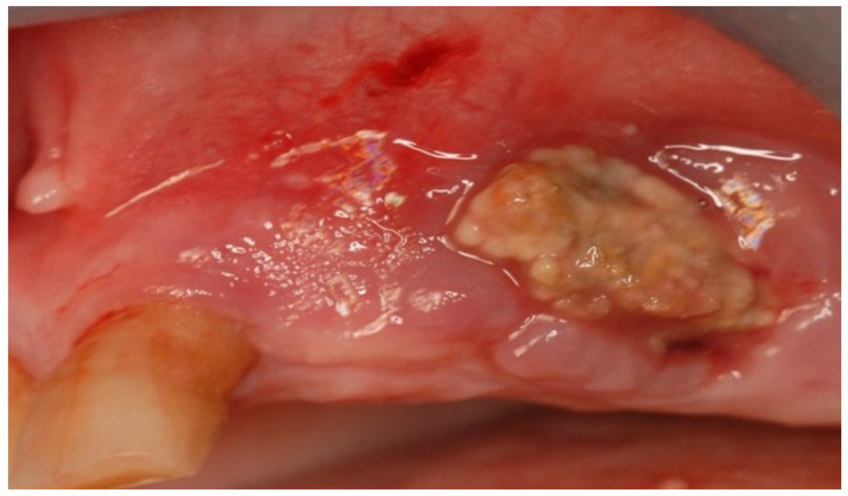 Bioengineering 10 00863 g011