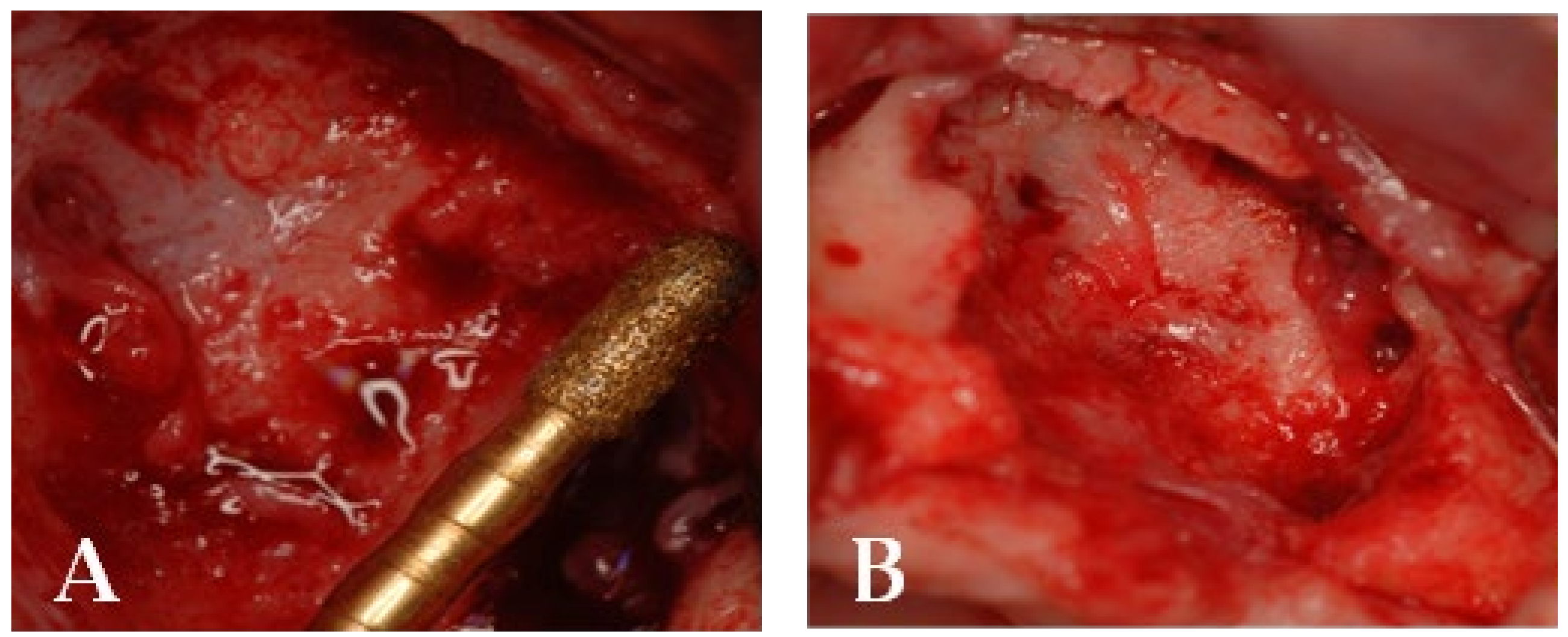 Bioengineering 10 00863 g013