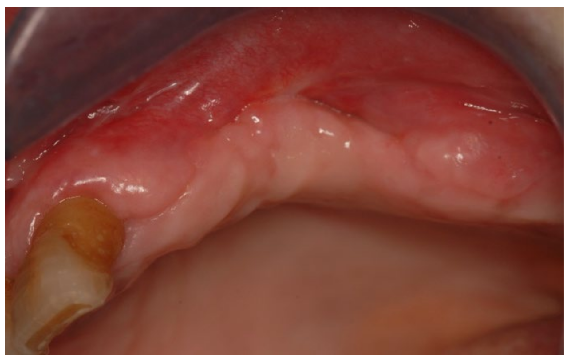 Bioengineering 10 00863 g015