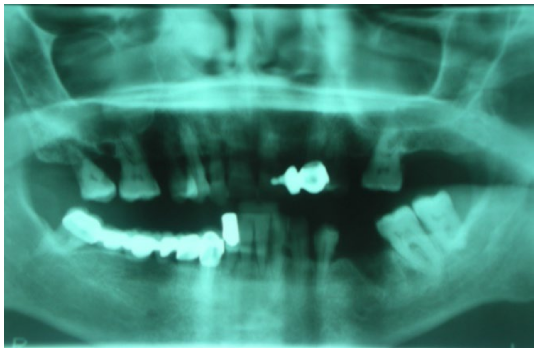 Bioengineering 10 00863 g016